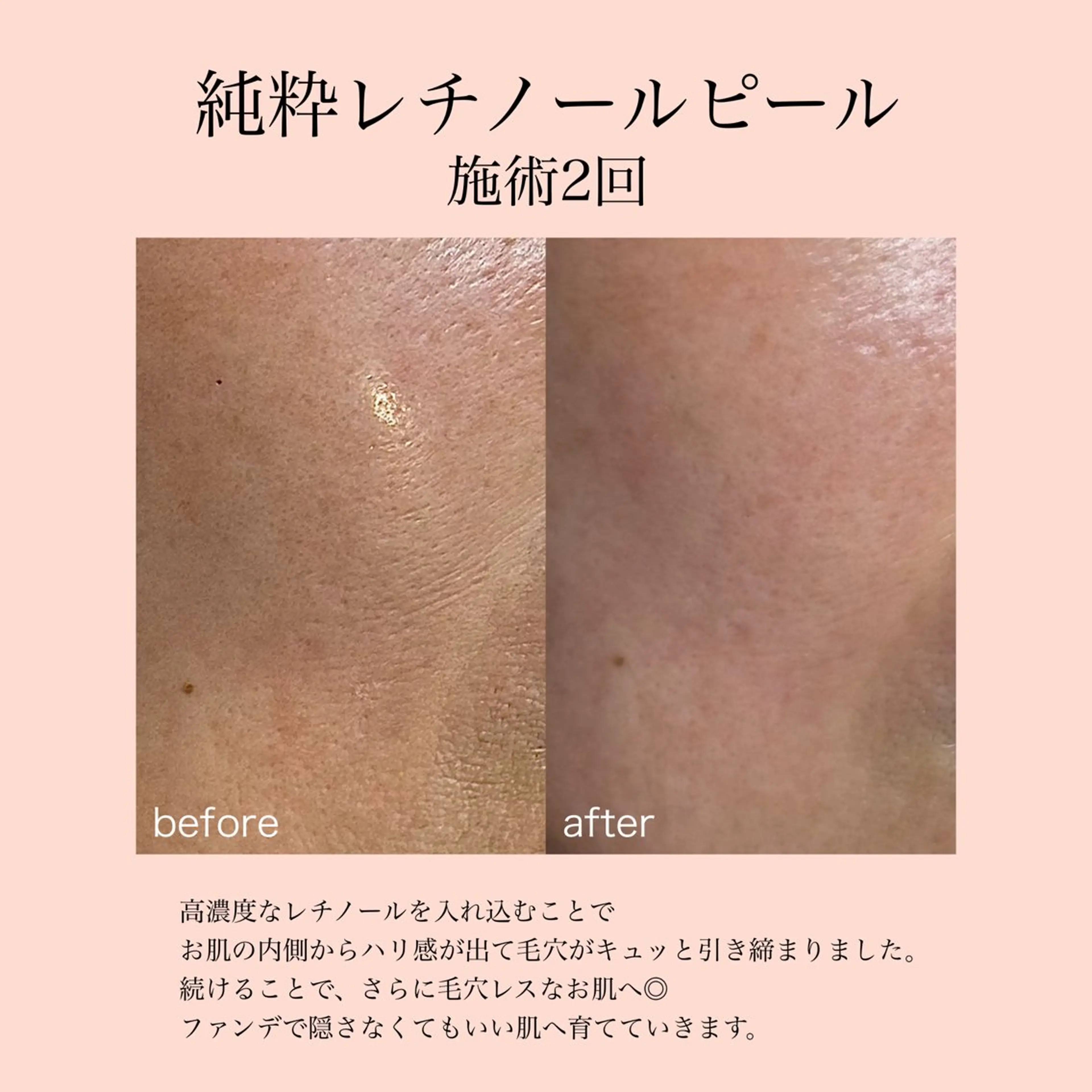 エステ 【結果が出る肌管理】 Ryanのエステ・リラクイメージ