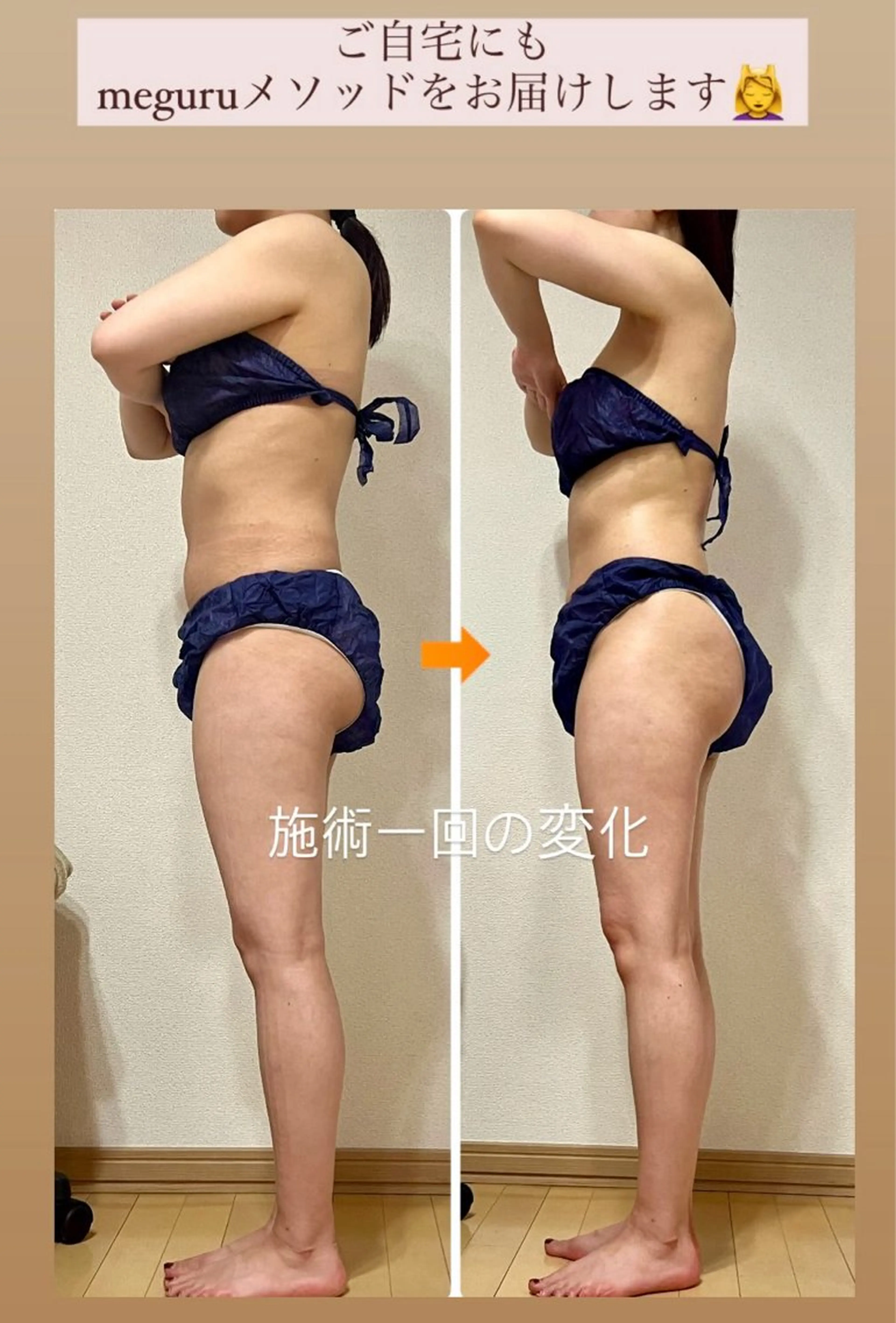 エステ リラク ‍痩身＆ボディ 結果出し🌟丹野のエステ・リラクイメージ