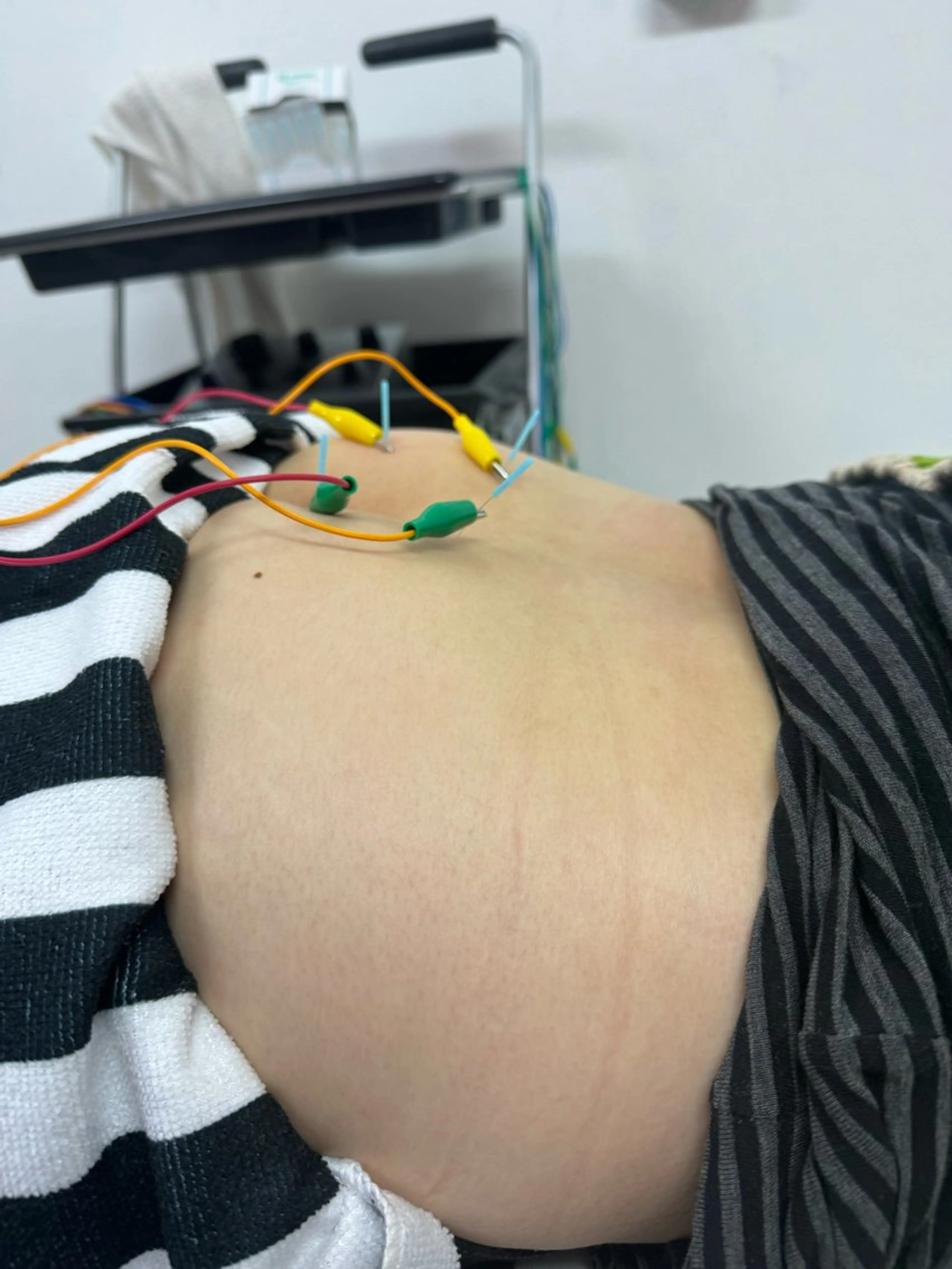 【初回体験】尿漏れお湯漏れ改善鍼&骨盤矯正【骨盤底筋トレ、産後の緩み】の写真