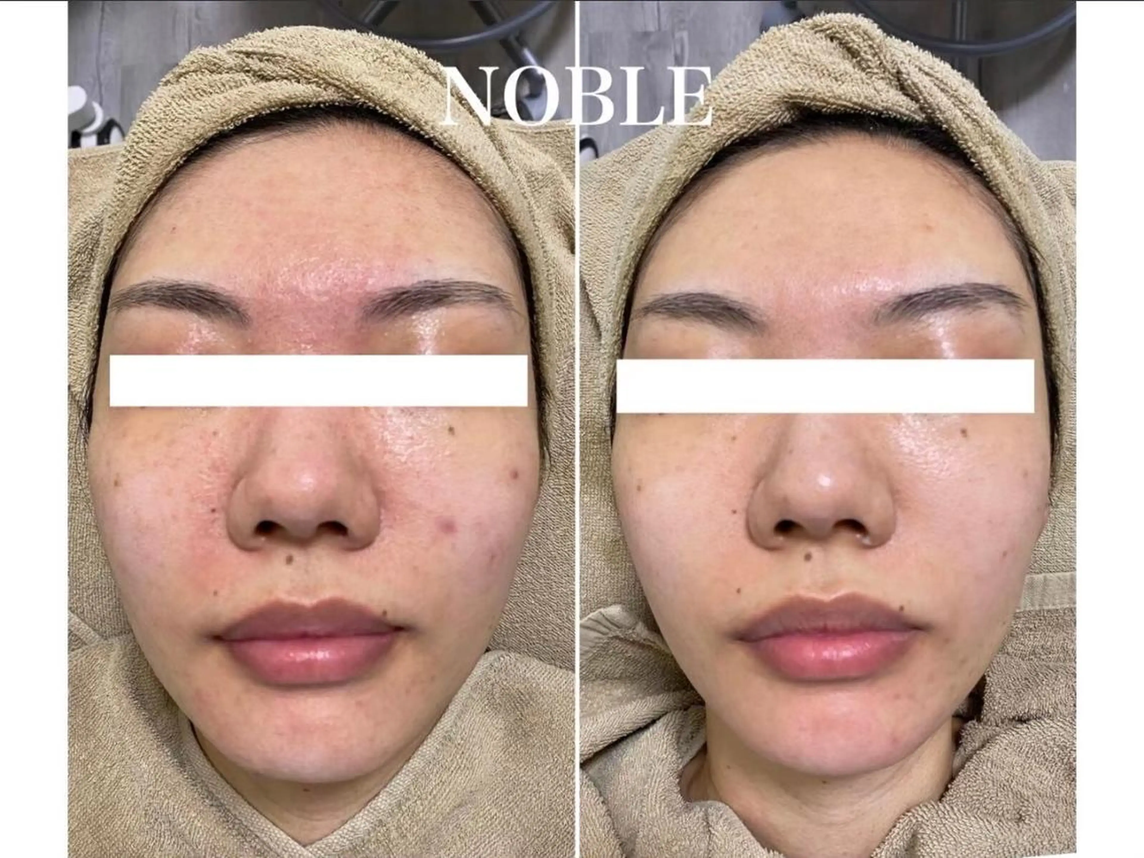 エステ NOBLE 新宿本店のエステ・リラクイメージ