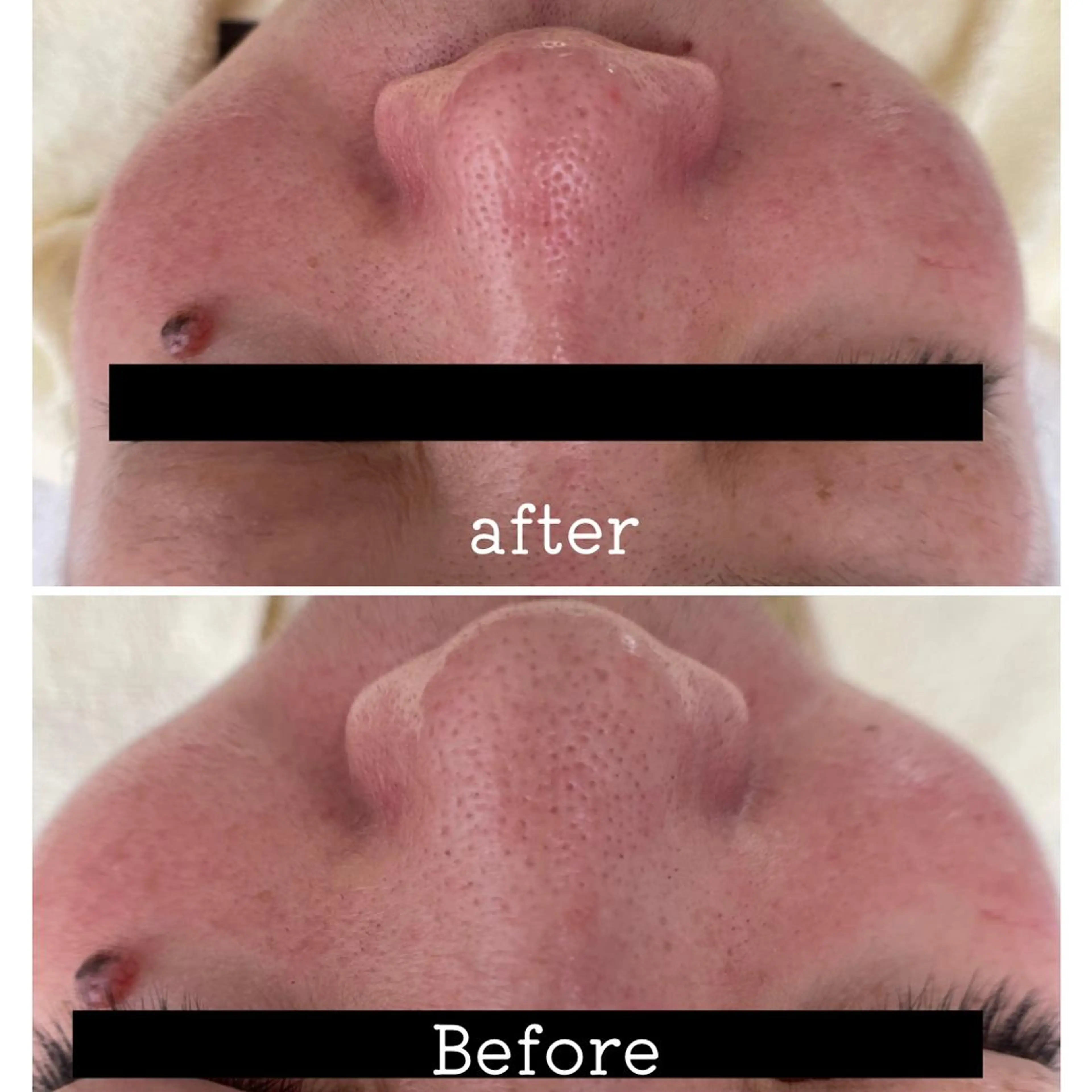 エステ É LINDA所属・E LINDAのネイルデザイン