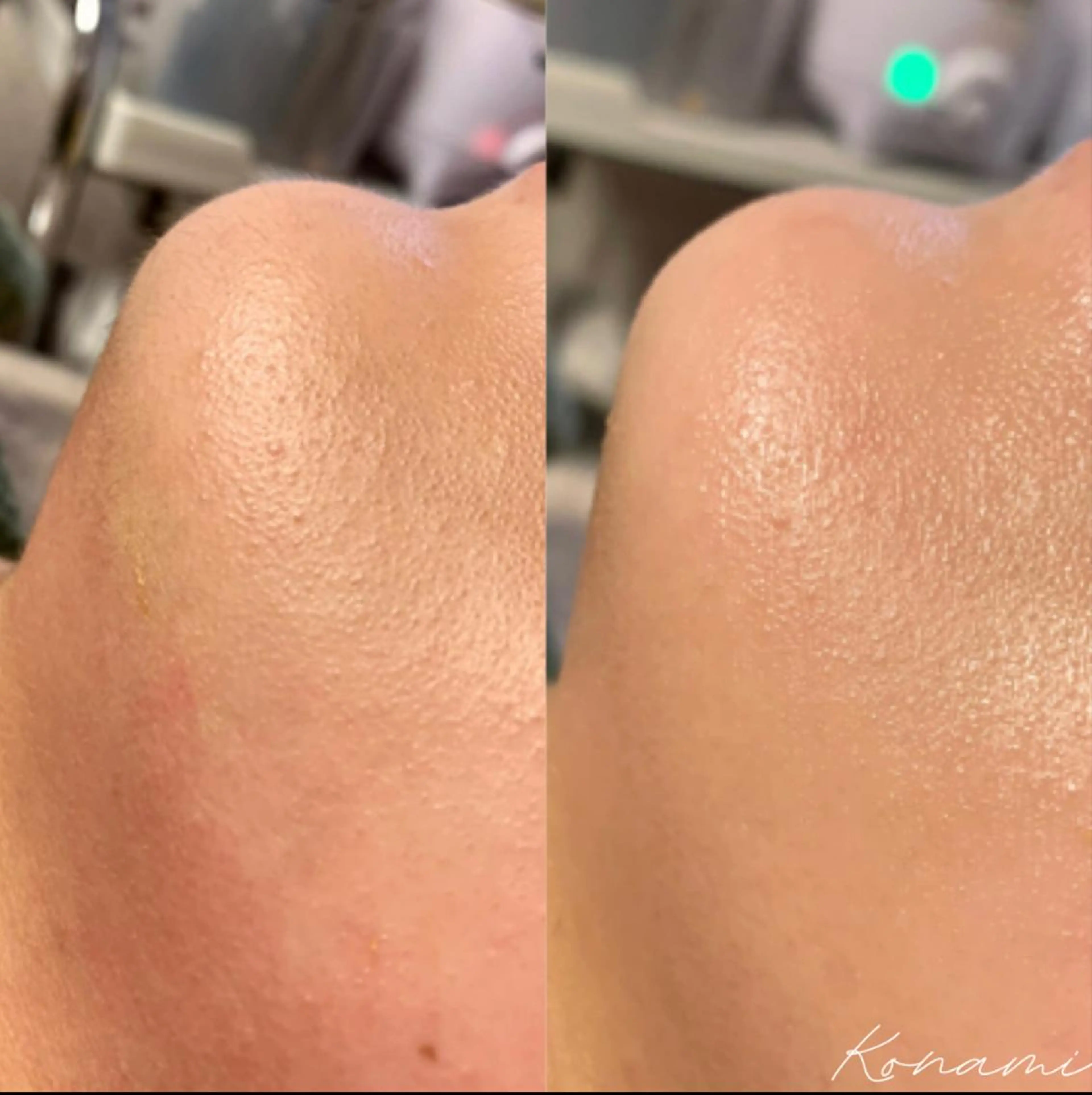 シードリン 府内店 小波のエステ・リラクイメージ