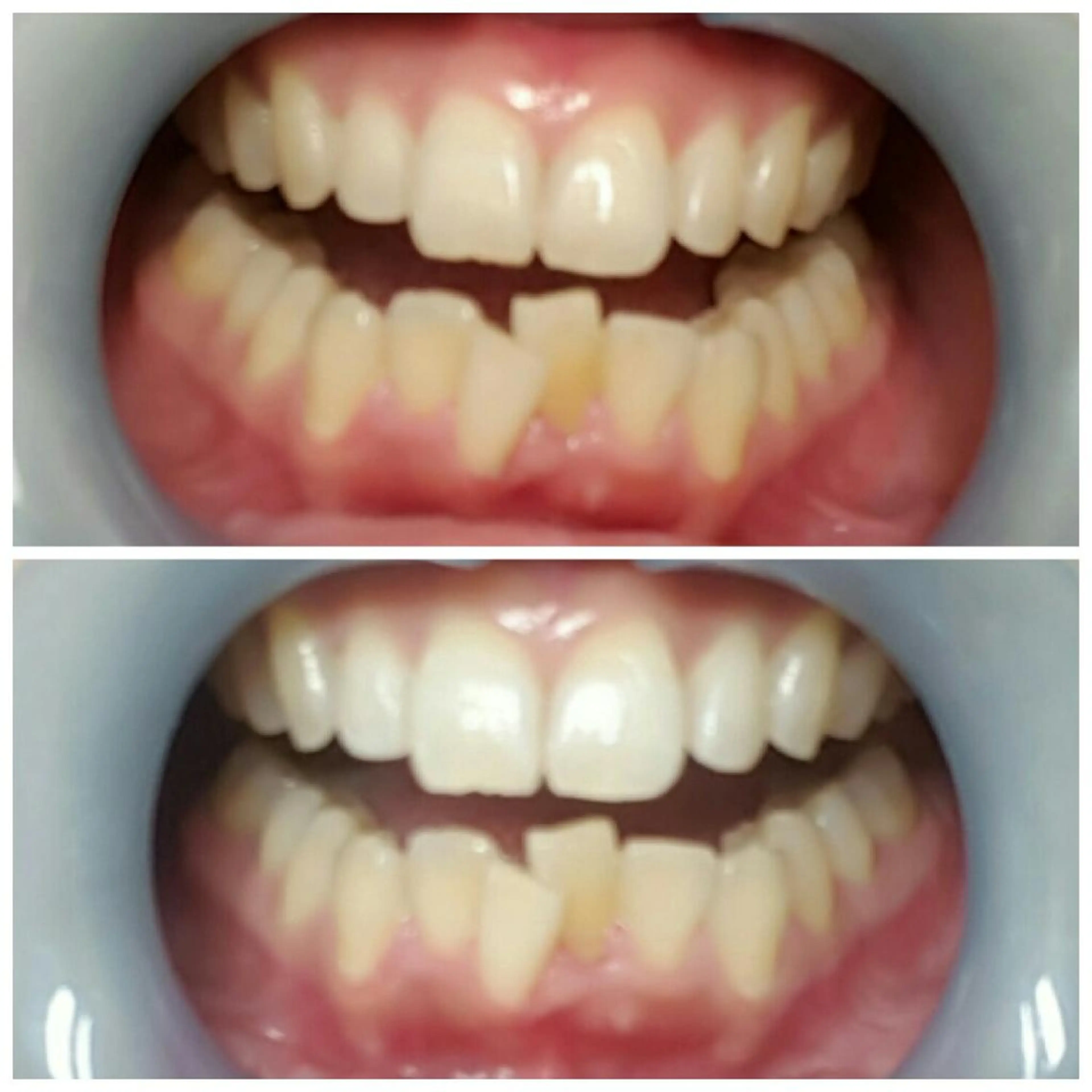 ネイリスト riiisaのネイルデザイン