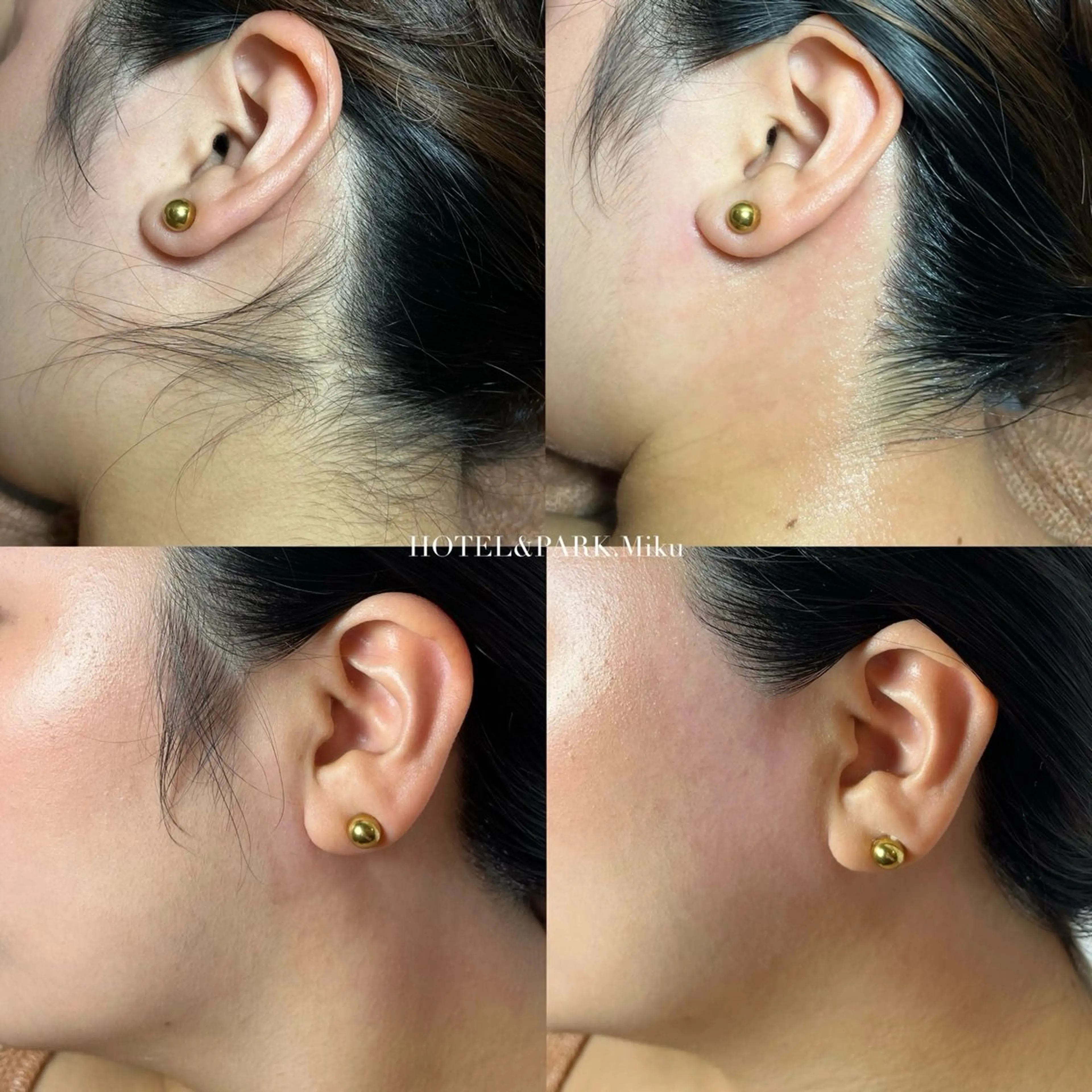 HOTEL&PARK Mikuワックス脱毛のエステ・リラクイメージ