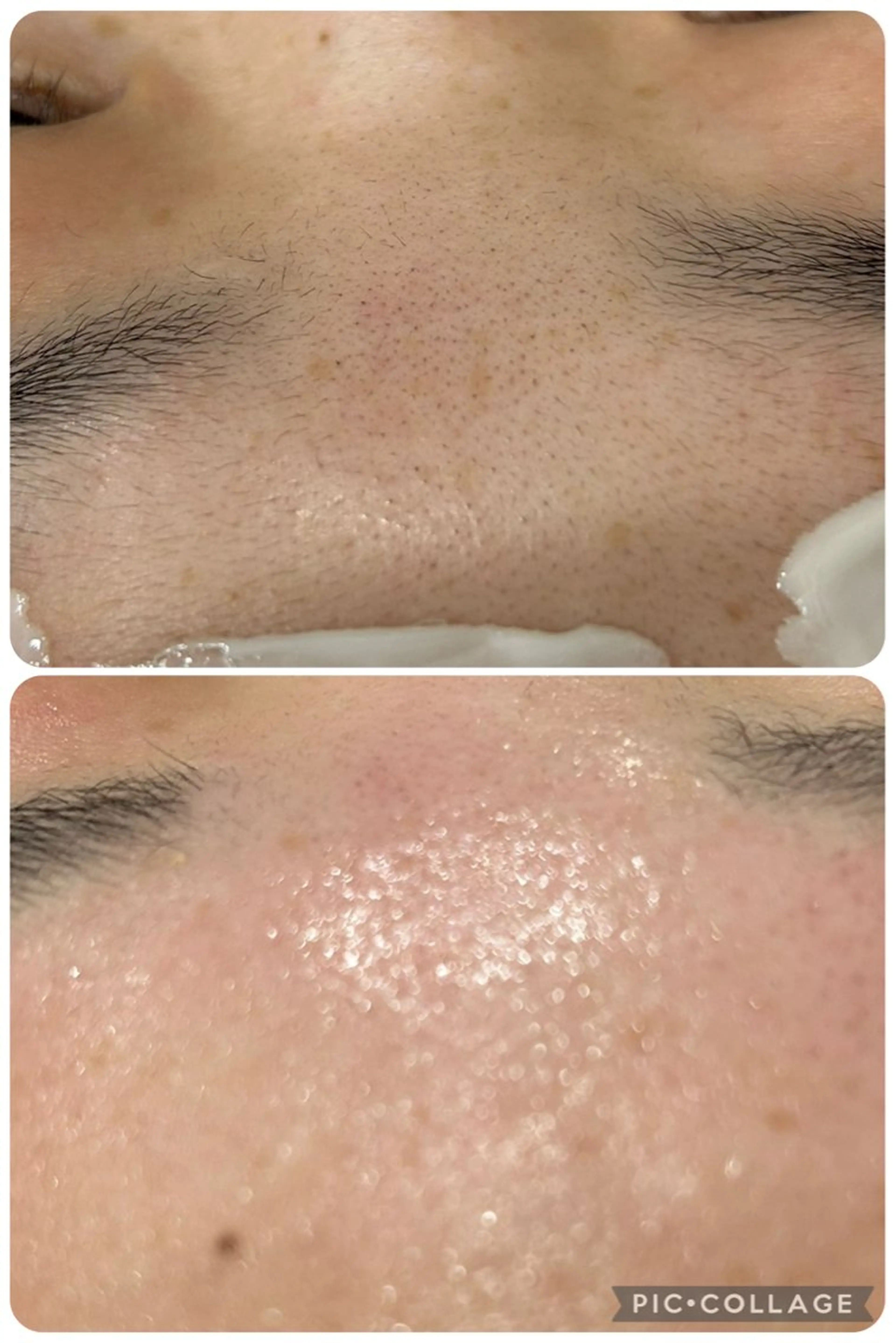 フェイスワックスの写真