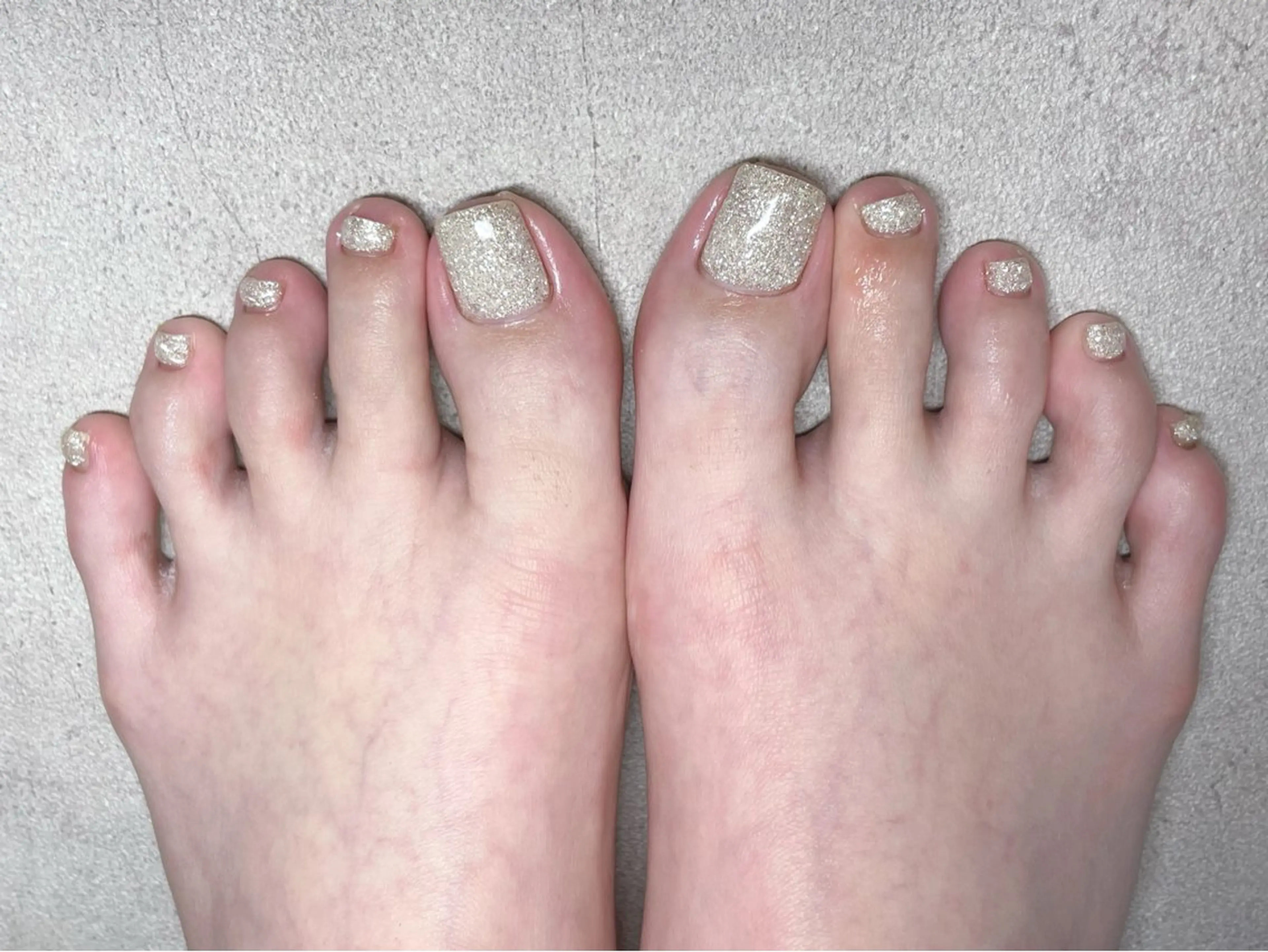 ネイル Garden 小野のネイルデザイン