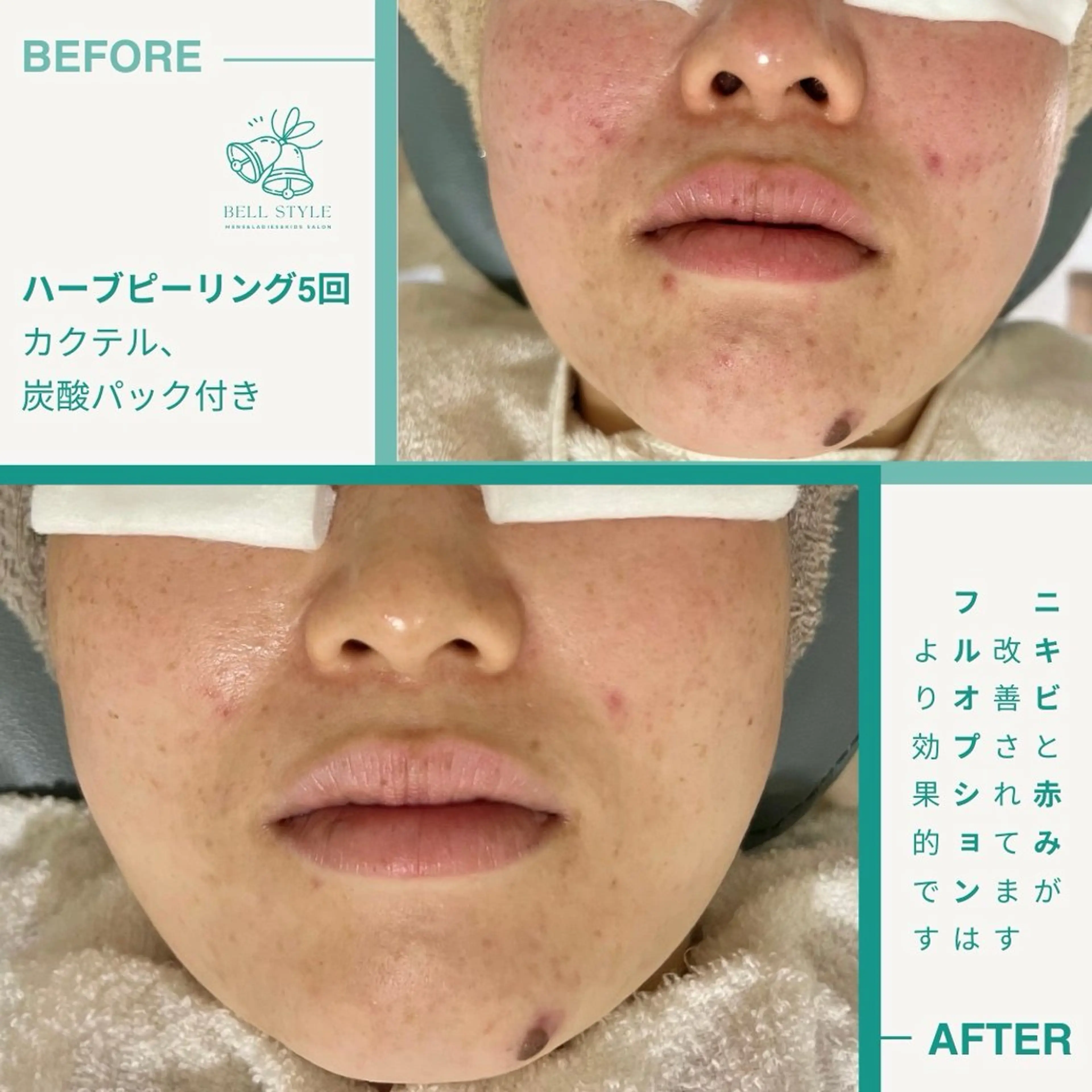 メンズ キッズ メンズ&レディース　Bell style所属・【脱毛・美肌専門】 bellstyleのエステ・リラクイメージ