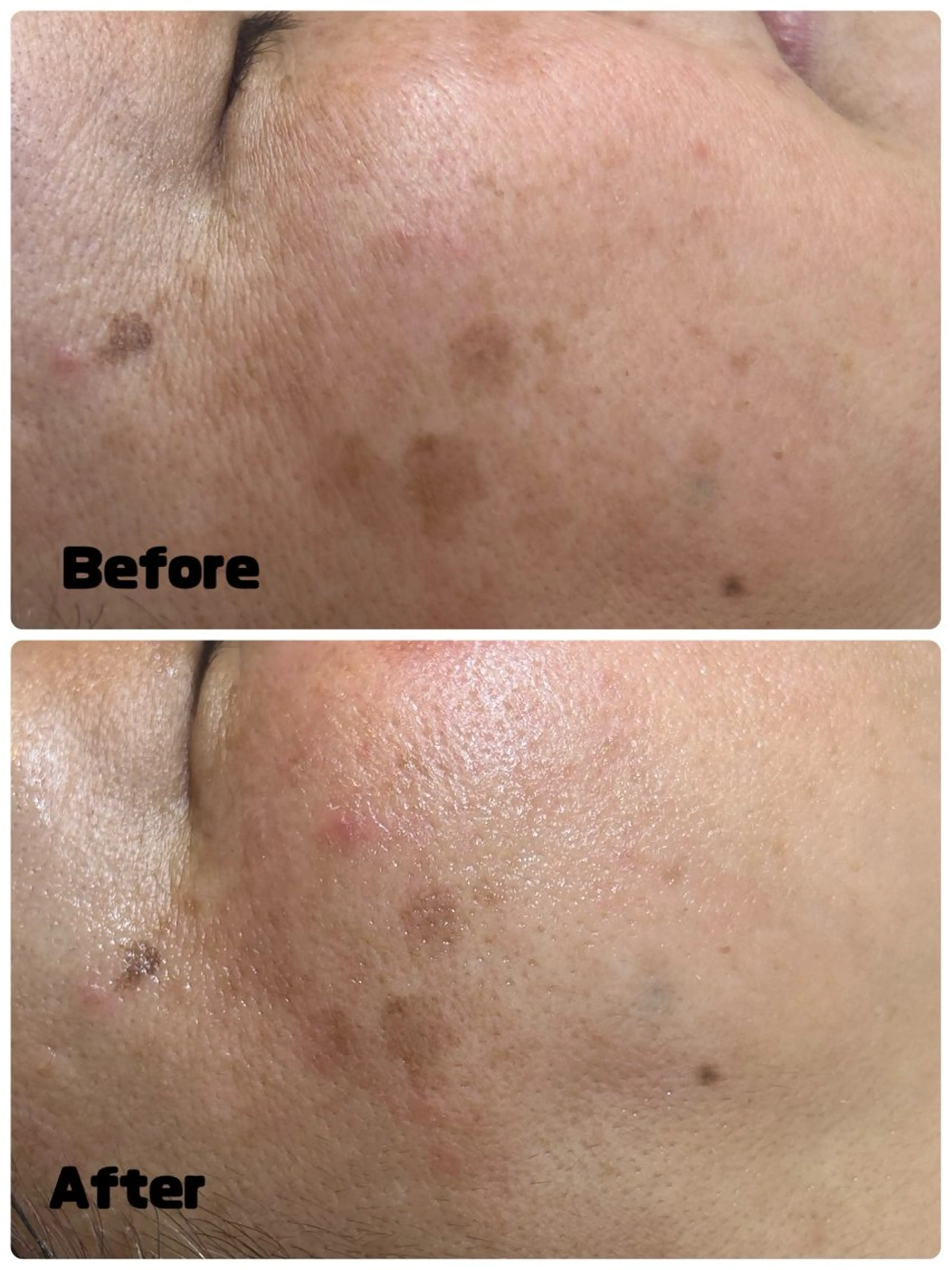 エステ Param所属・Param Femcareのエステ・リラクイメージ