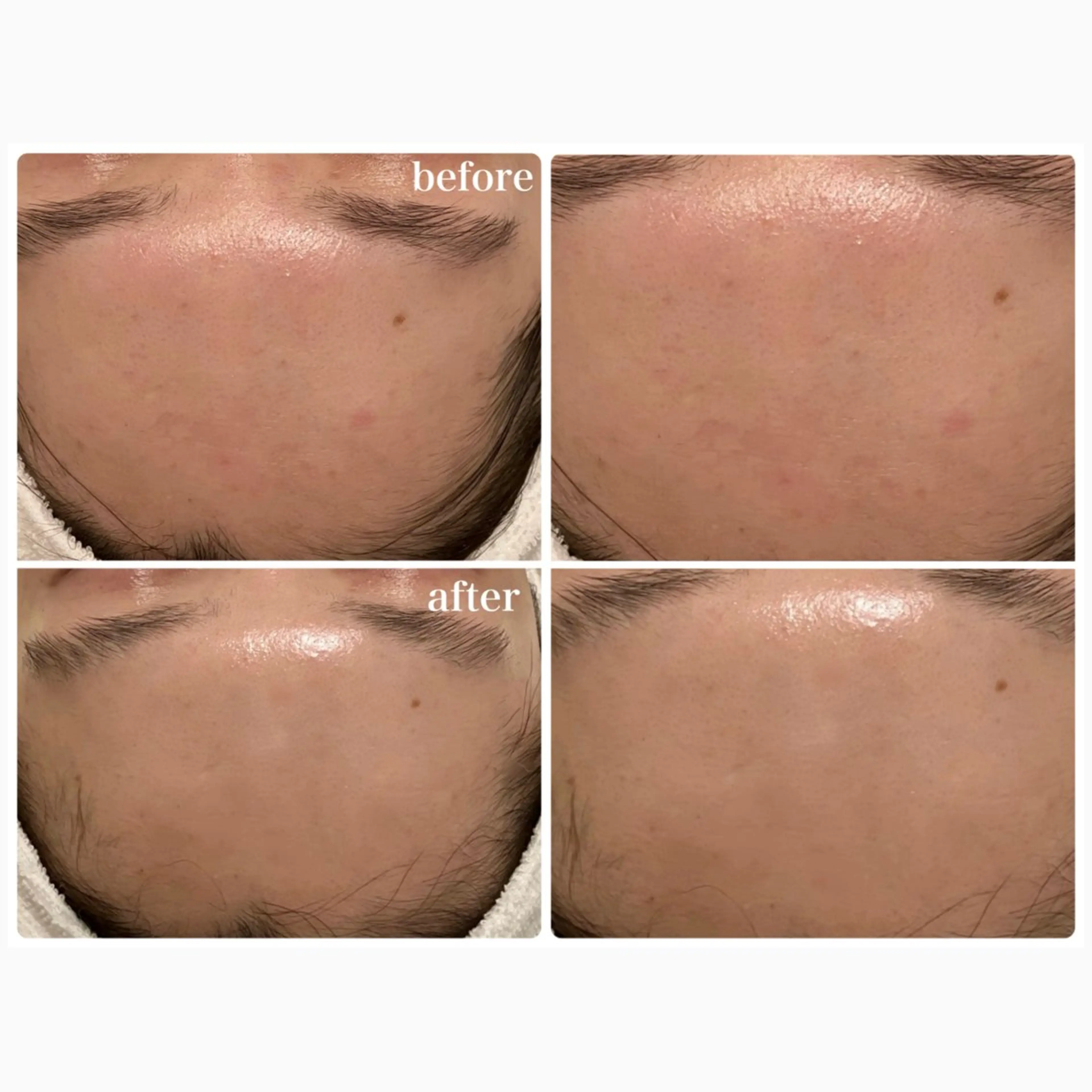 Lily branc 痩身/小顔/肌質改善のエステ・リラクイメージ