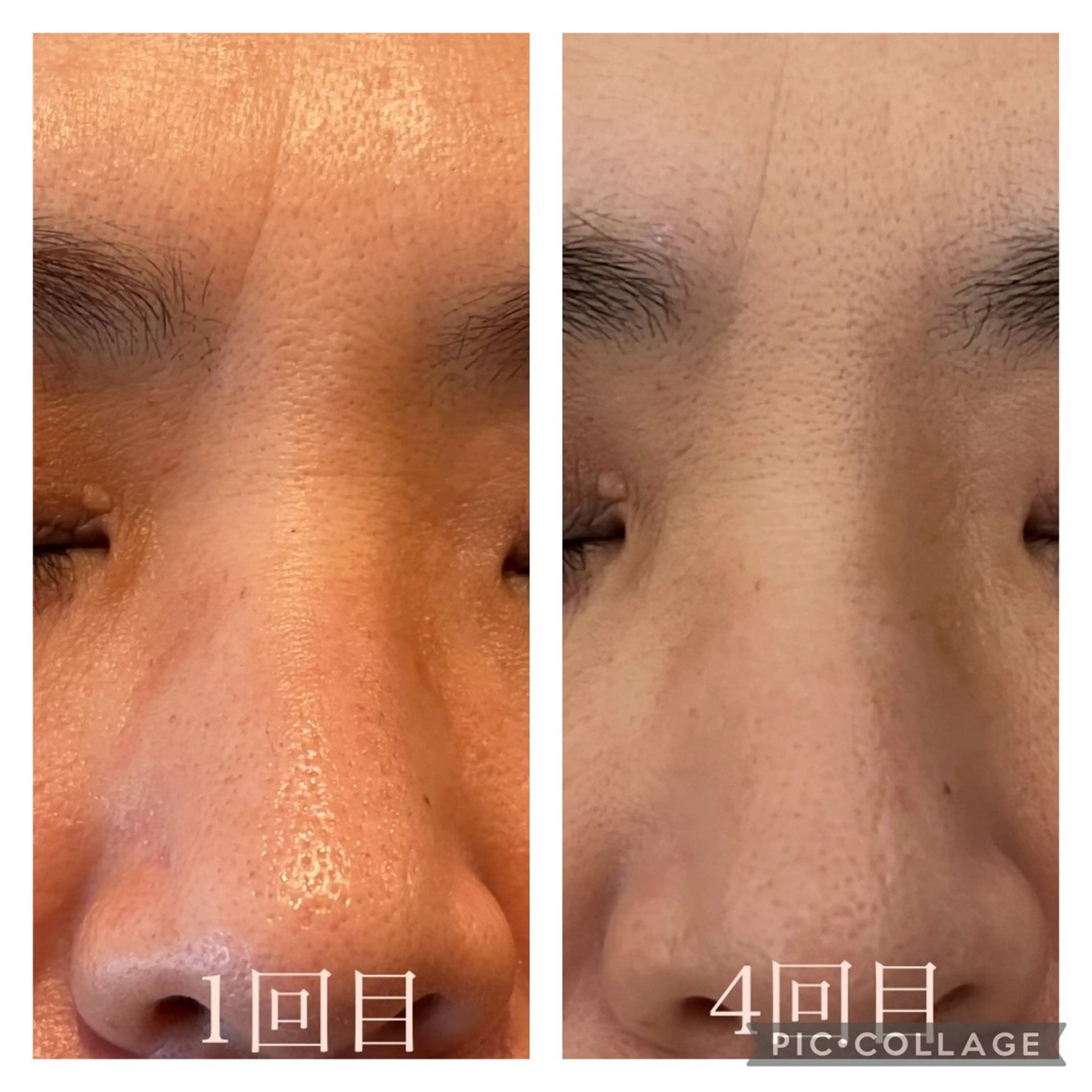 隠れ家フェイシャル&ドライヘッドケア新座所属・隠れ家フェイシャル＆ ドライヘッドケア新座のエステ・リラクイメージ