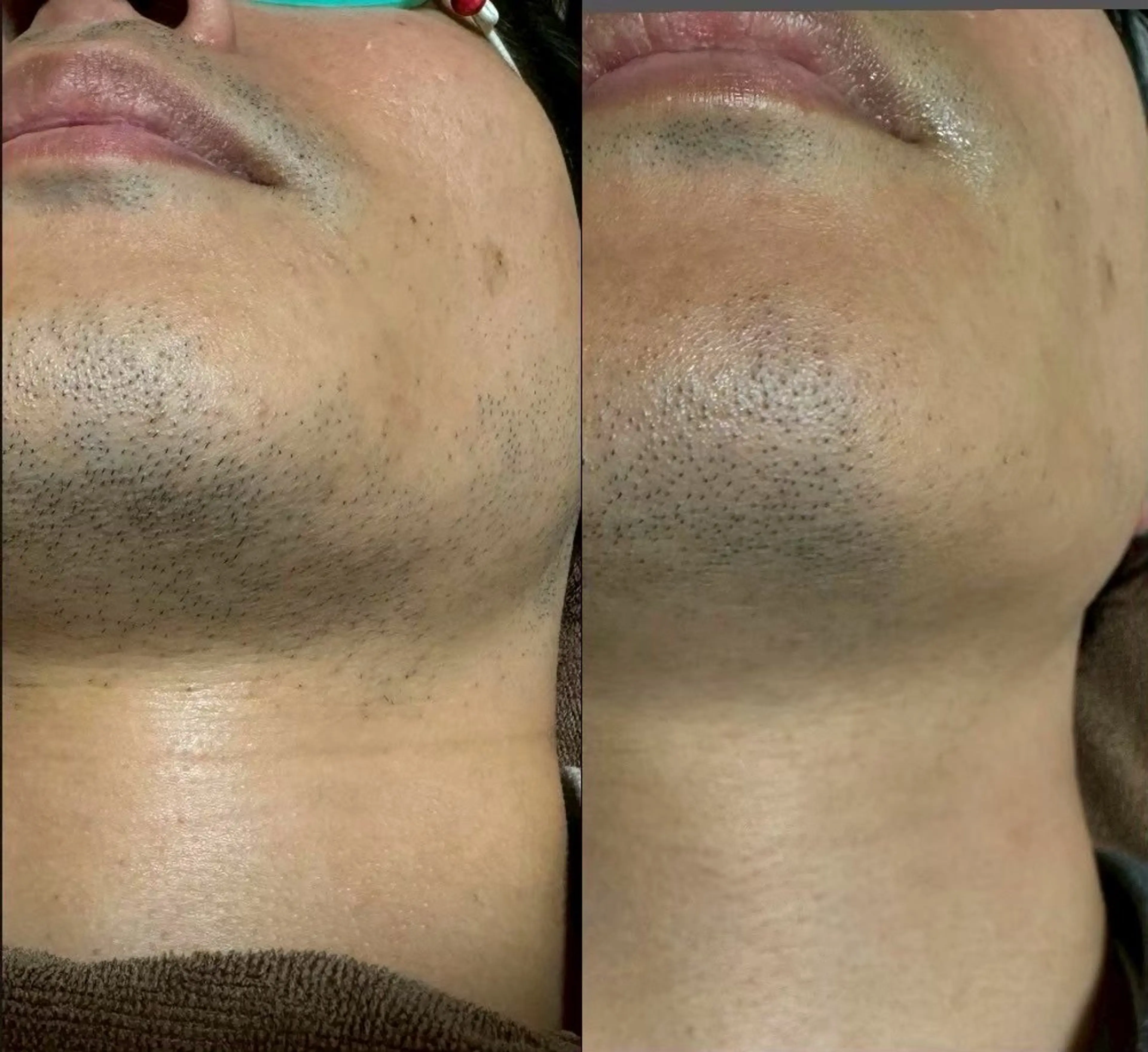 六本木脱毛andS さおりのエステ・リラクイメージ