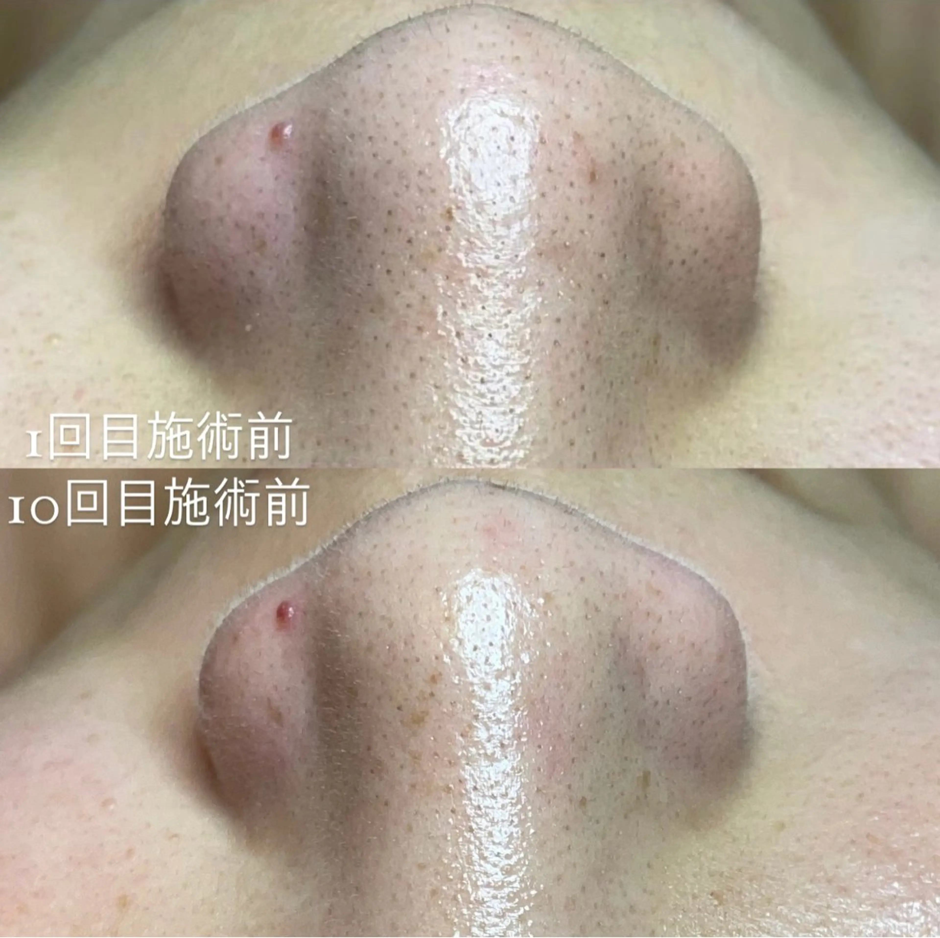 エステ リラク セルフエステエンリケ明石大久保店所属・夕希リンパ&痩身& 脱毛&毛穴ケアのエステ・リラクイメージ