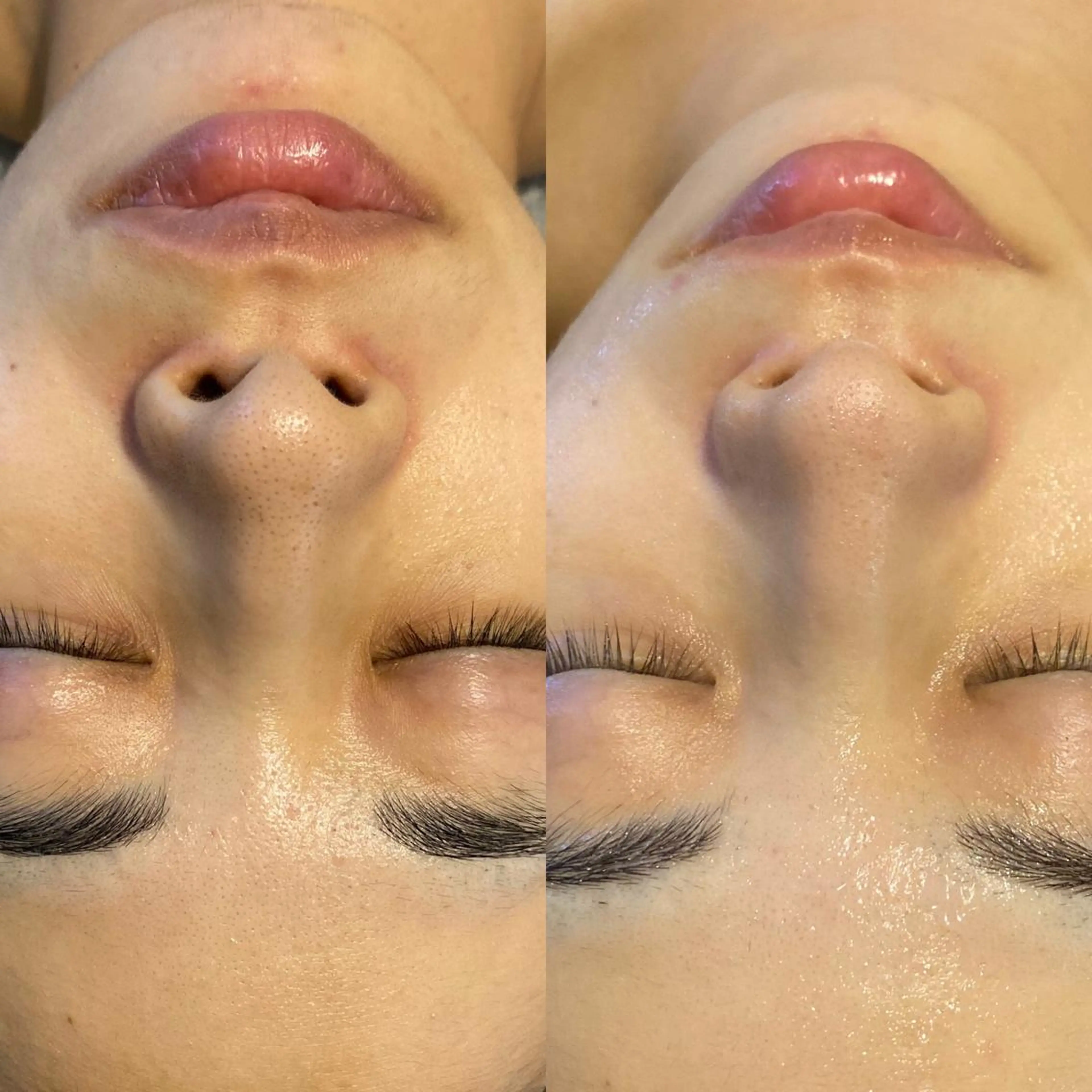 Meetite 小林のエステ・リラクイメージ