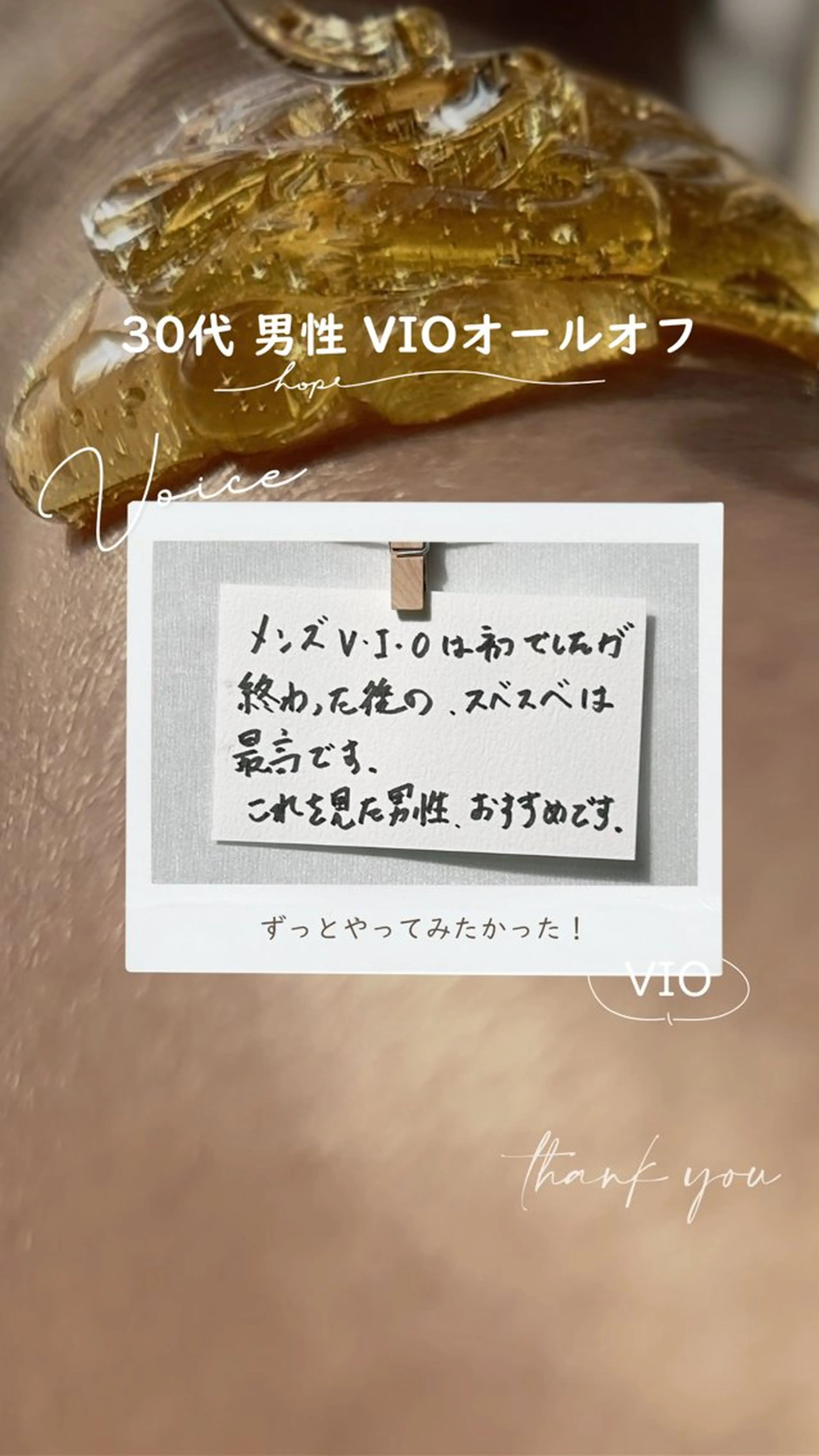 Hit. シュガーリング豊橋のエステ・リラクイメージ