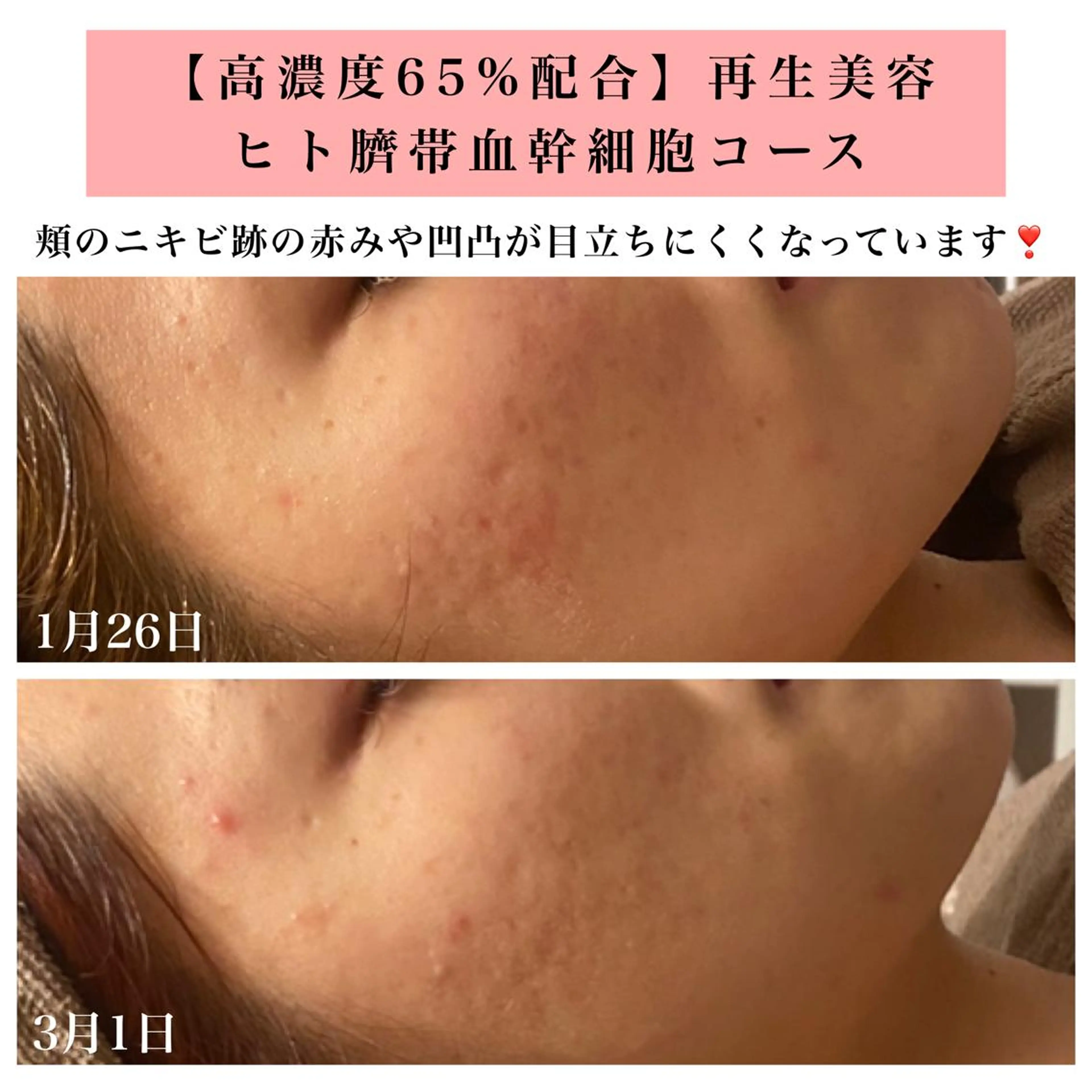 エステ リラク Bellesthe （ベルエステ）のエステ・リラクイメージ