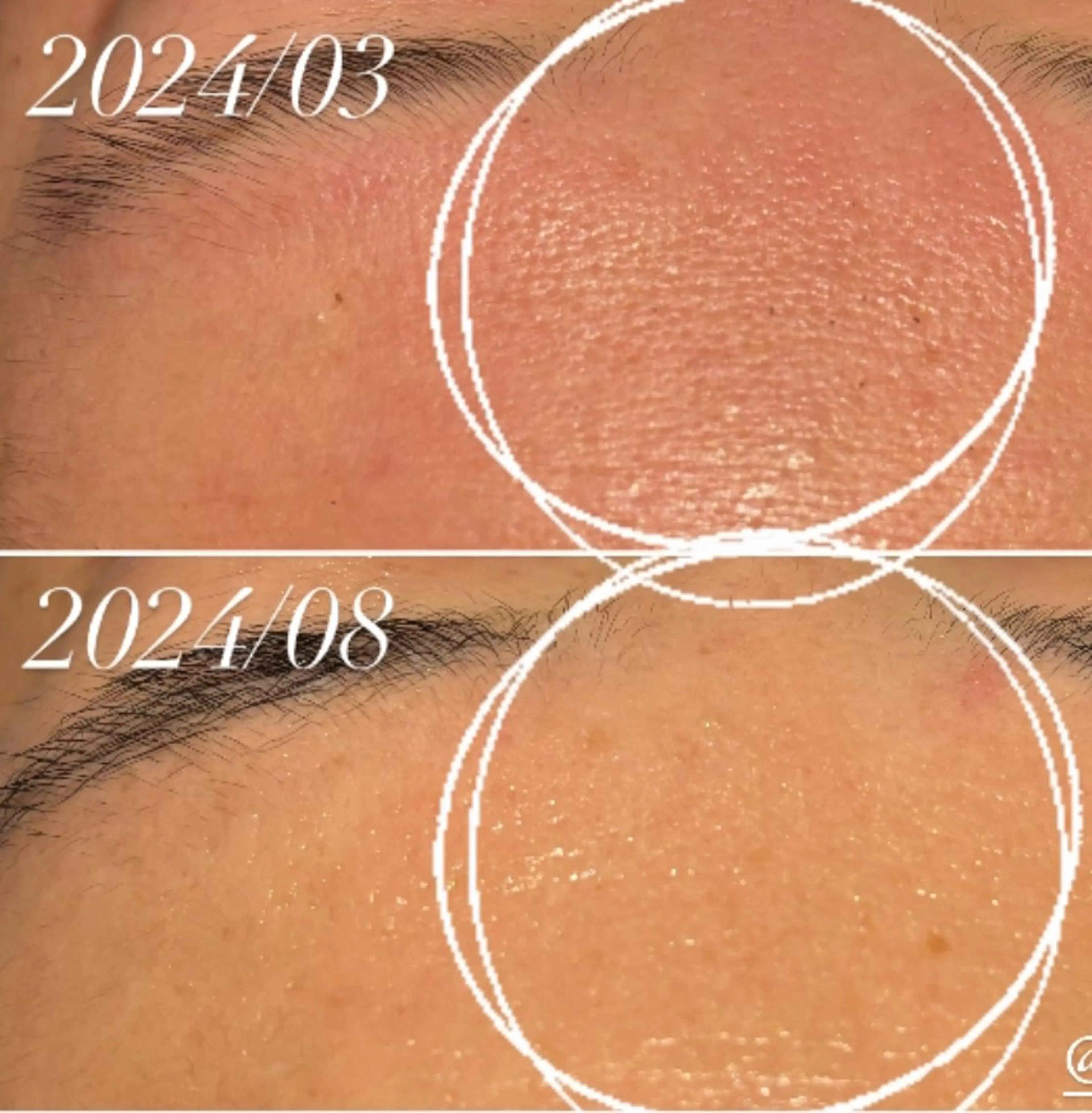 【ふっくらハリ肌へ💫】年齢サインに✦フォーエバーヤング|クリスティーナ天王寺・大阪💎の写真