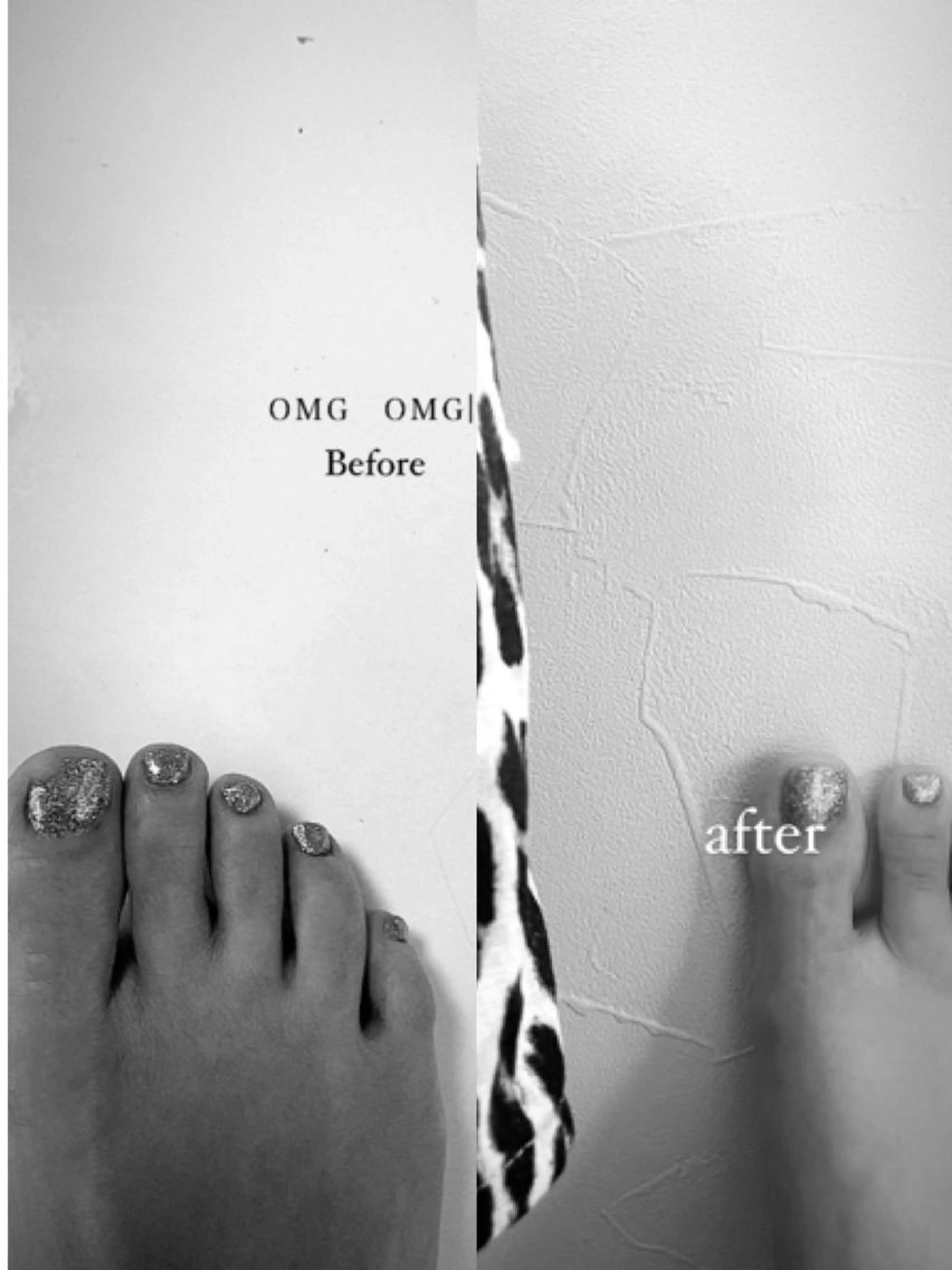 亀裂補強　[1本]の写真