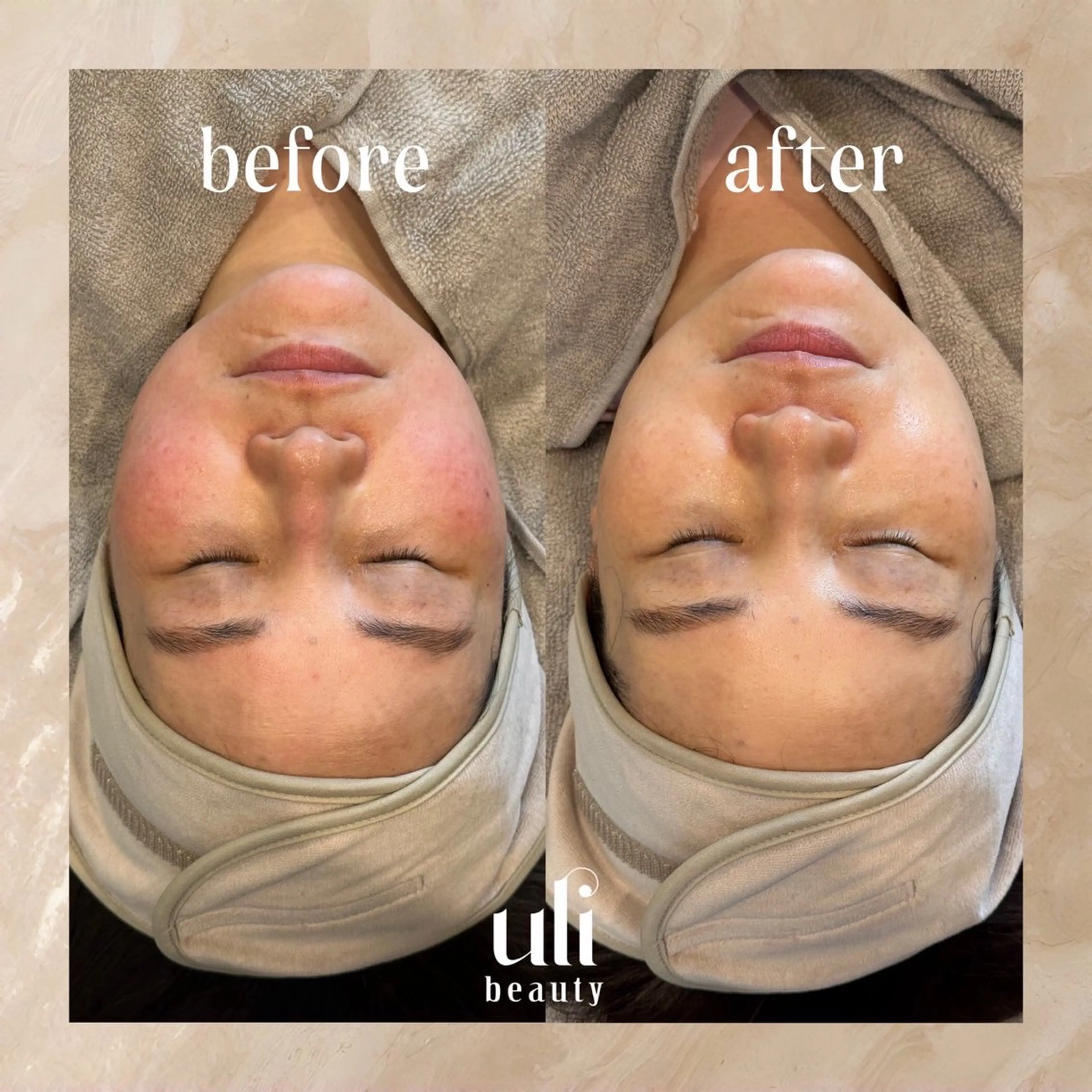 エステ uli beauty所属・韓国肌管理サロン ulibeautyのエステ・リラクイメージ