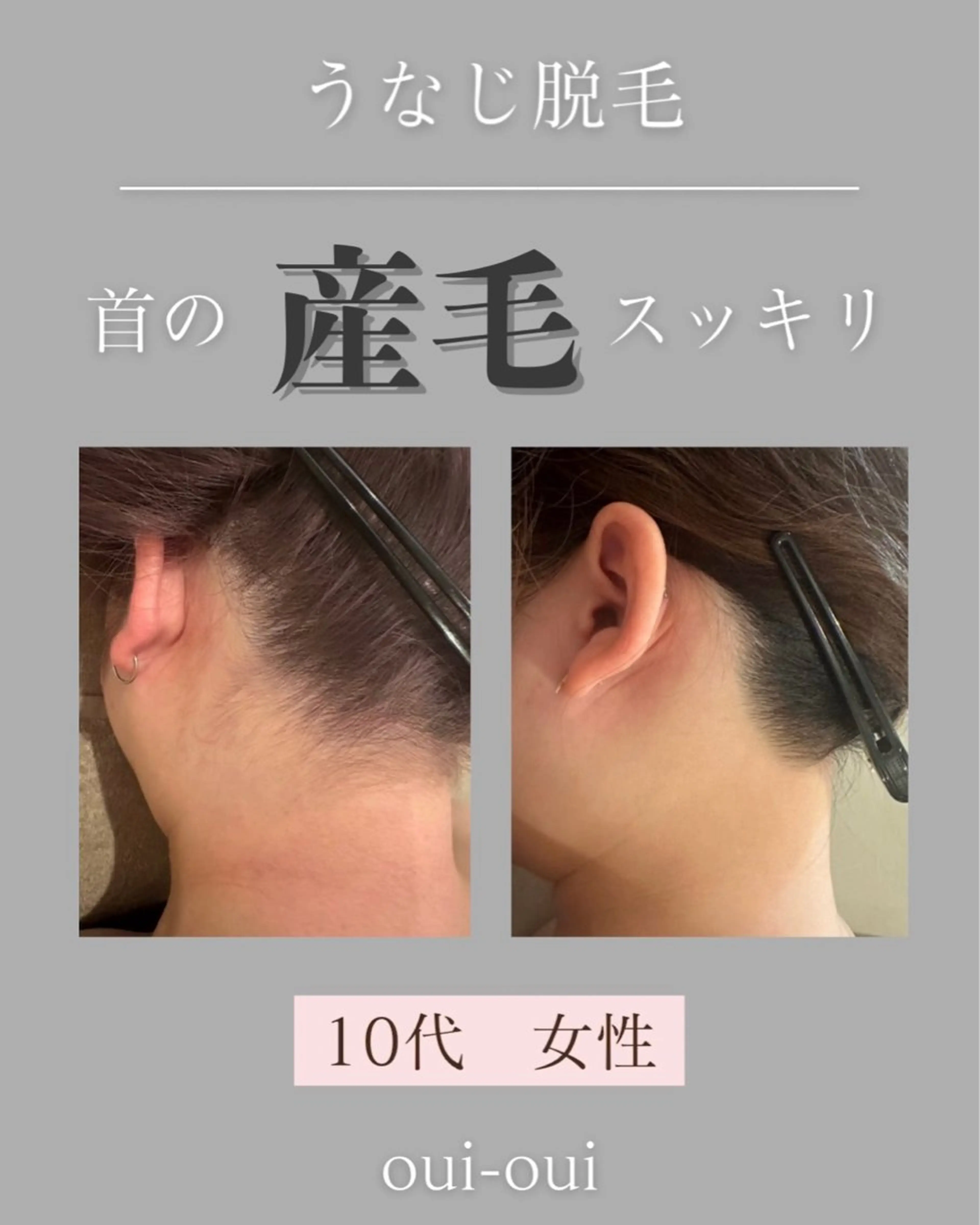 oui-oui　ウィウィ所属・oui-oui 磐田脱毛のエステ・リラクイメージ