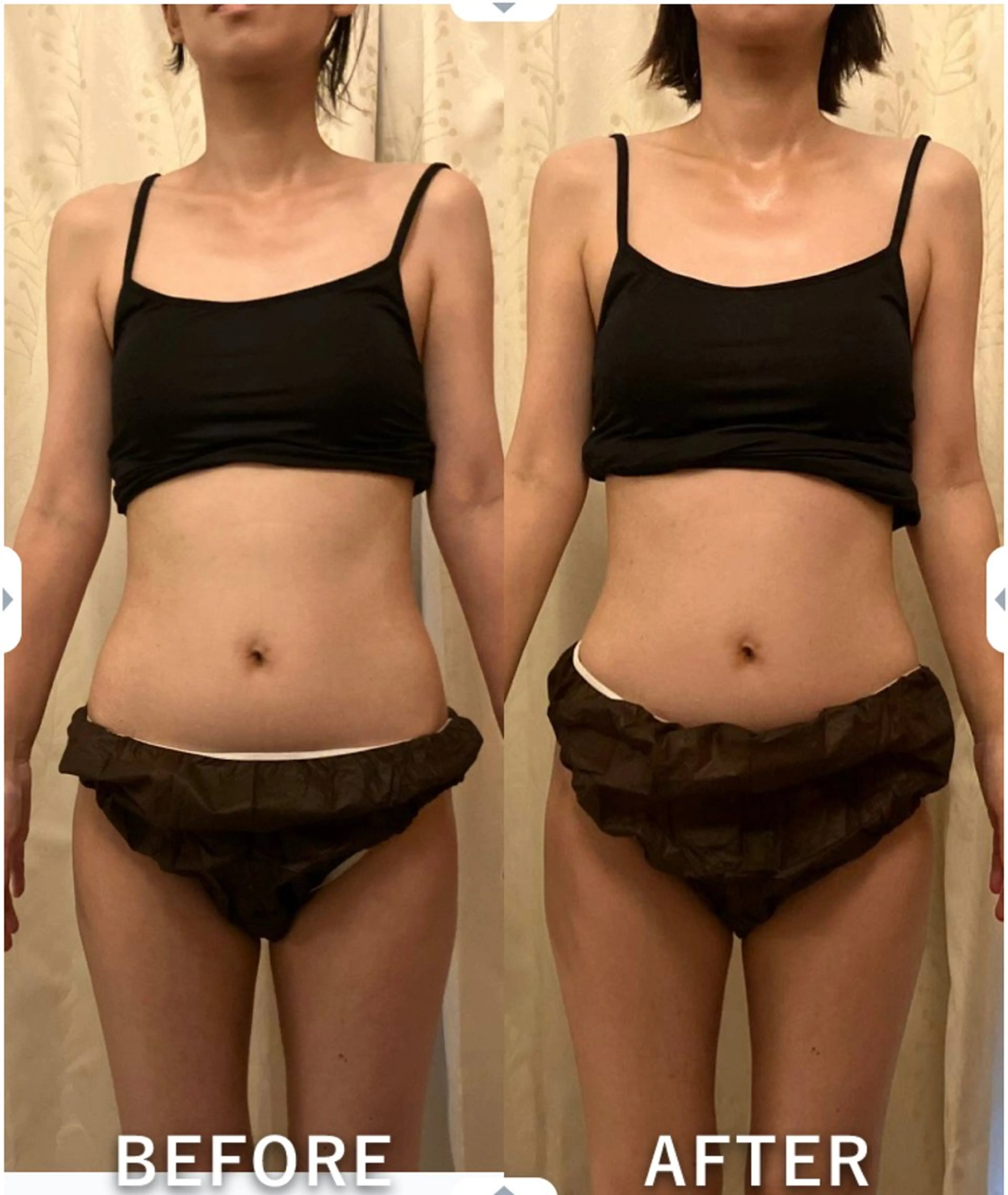 θTHETAメソッド　シエスタ所属・siesta バストアップ痩身のエステ・リラクイメージ