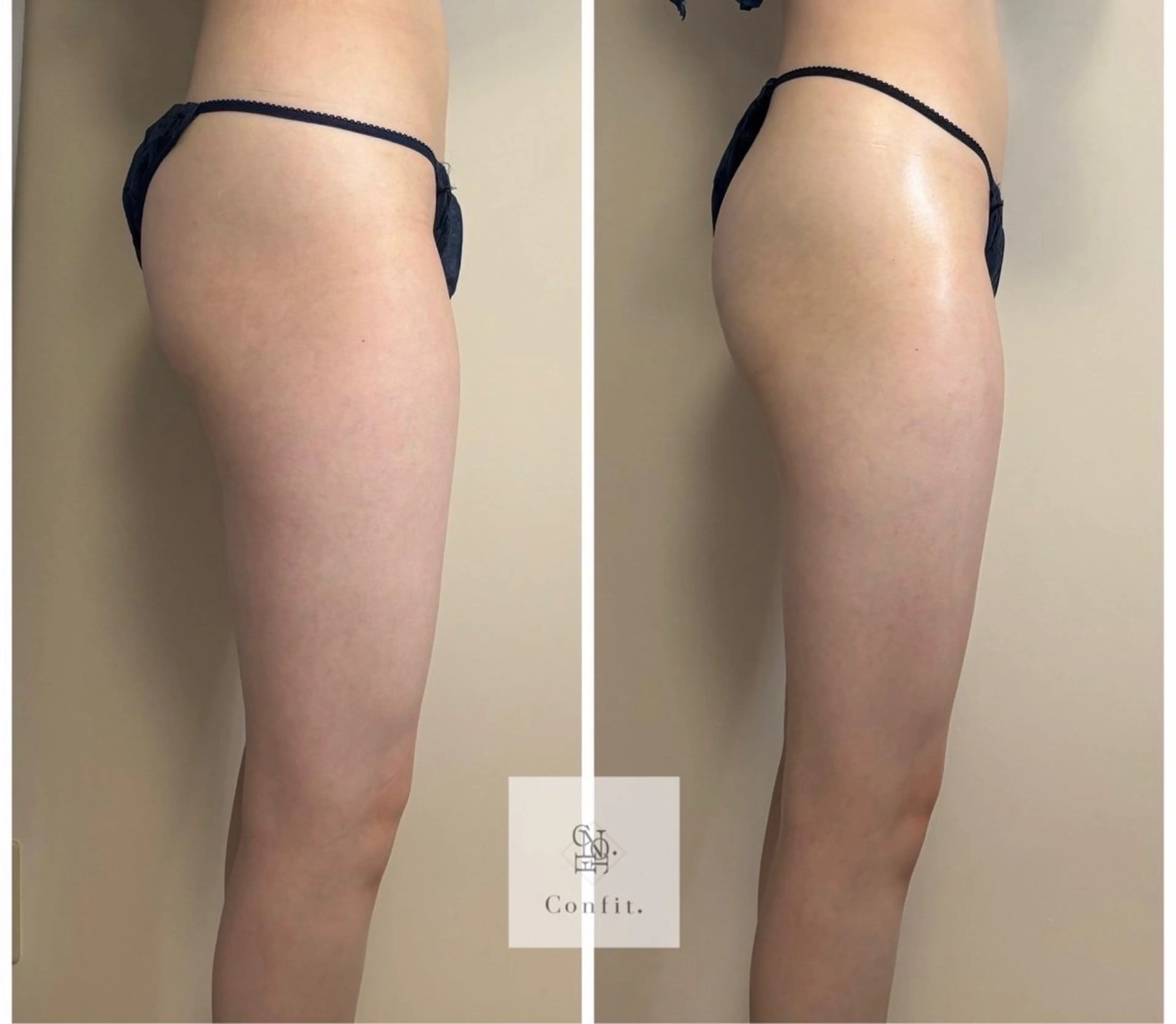 エステ 小顔/たるみ/黒ずみ除去専門サロン/SONA 大和西大寺店所属・【小顔痩身専門看護師 サロンSONA】のエステ・リラクイメージ