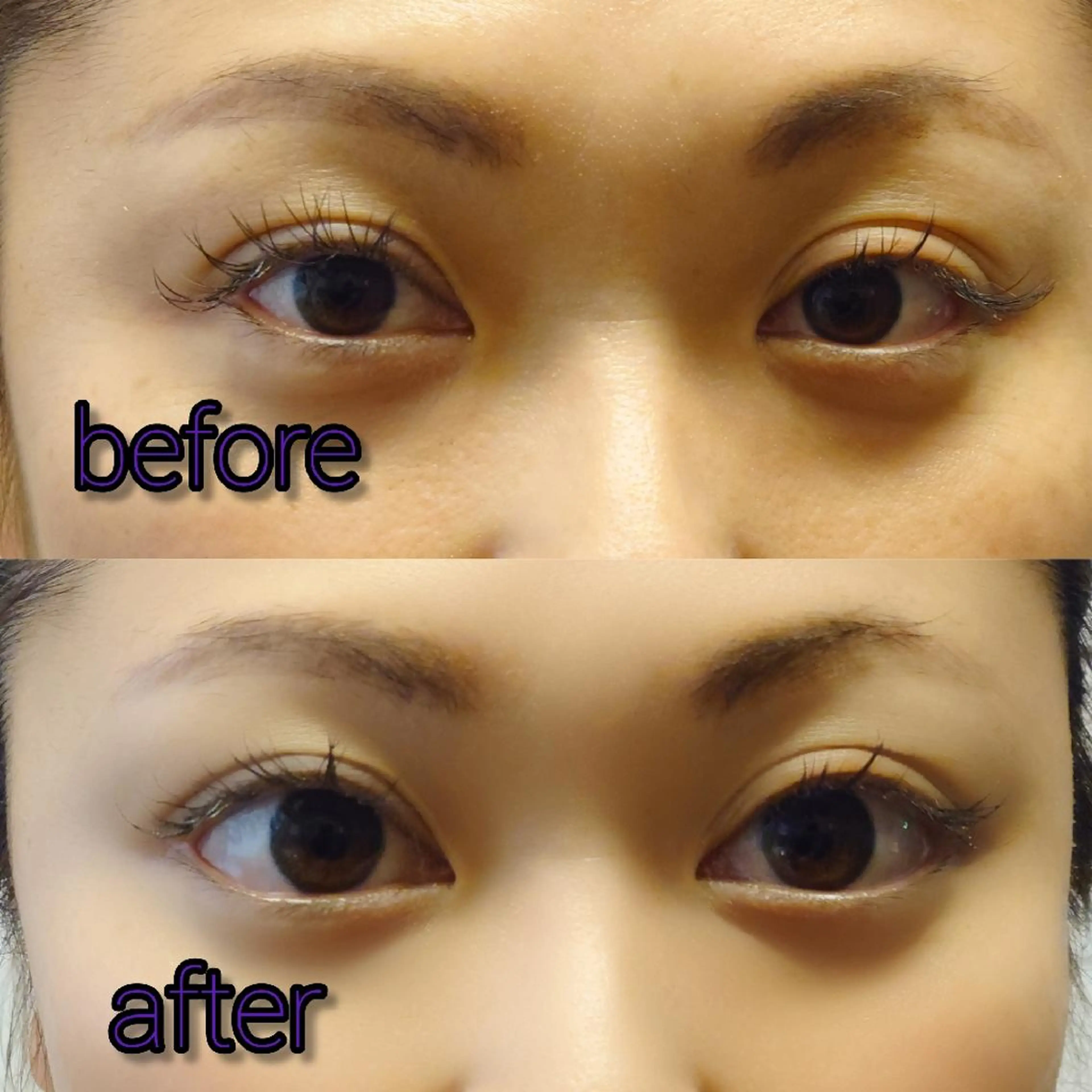 北梅田美容鍼灸院所属・美容鍼マイスター 川村　淳のエステ・リラクイメージ