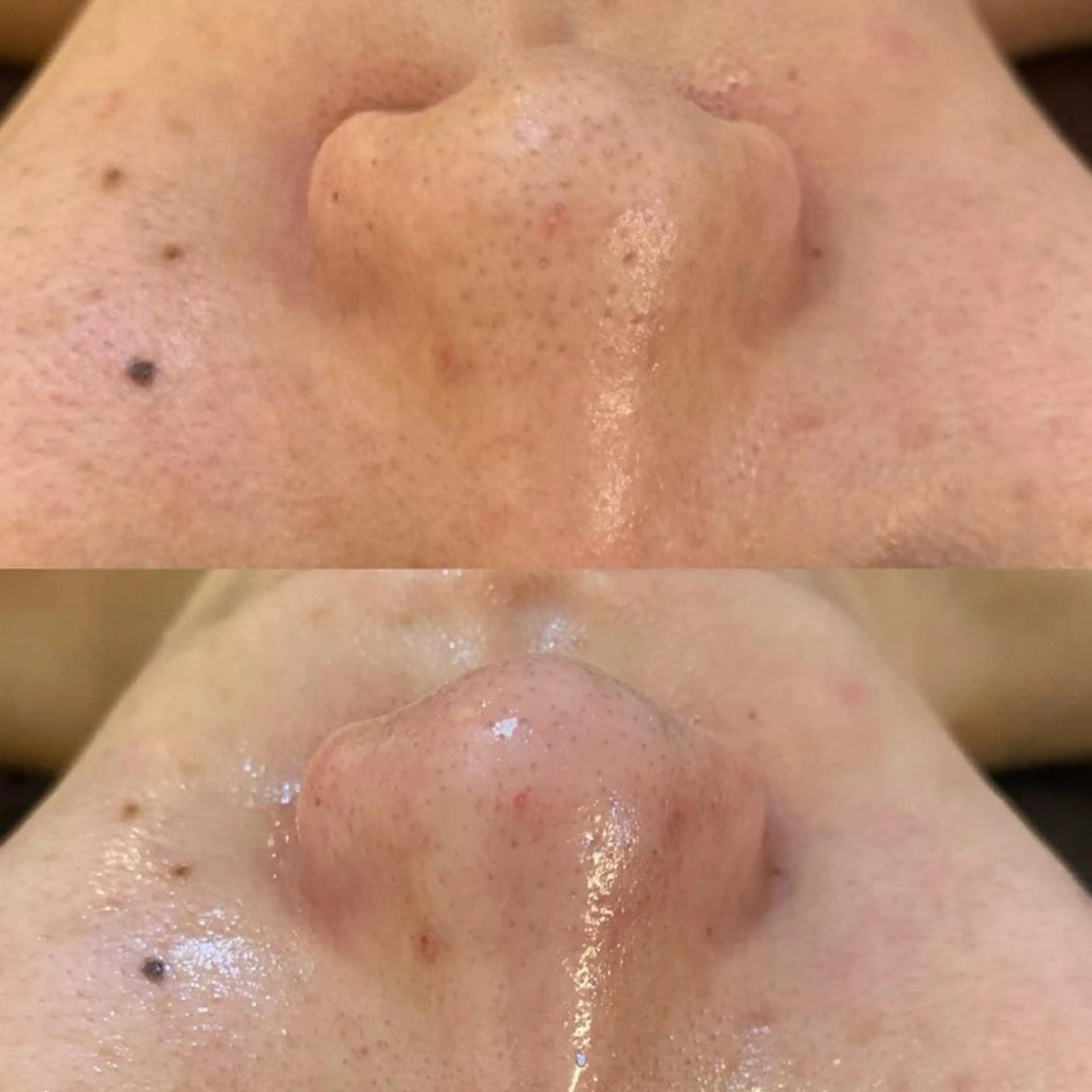 エステ リラク BELCIA福岡店　récolte de BELCIA（レコルトデベルシア）所属・BELCIA福岡店 レコルトデベルシアのエステ・リラクイメージ