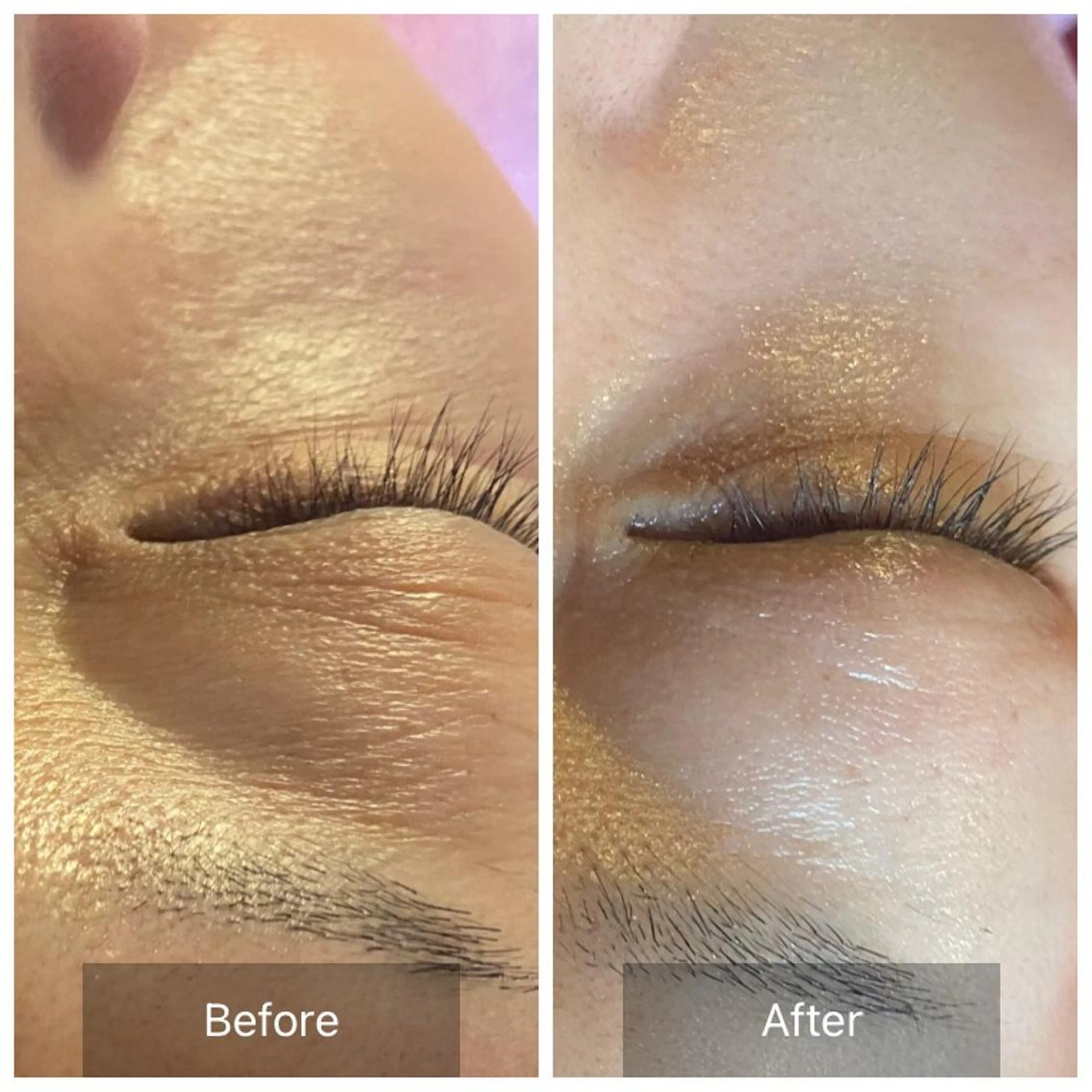 Mandarin Orange所属・毛穴から始める肌メン テマンダリンオレンジのエステ・リラクイメージ