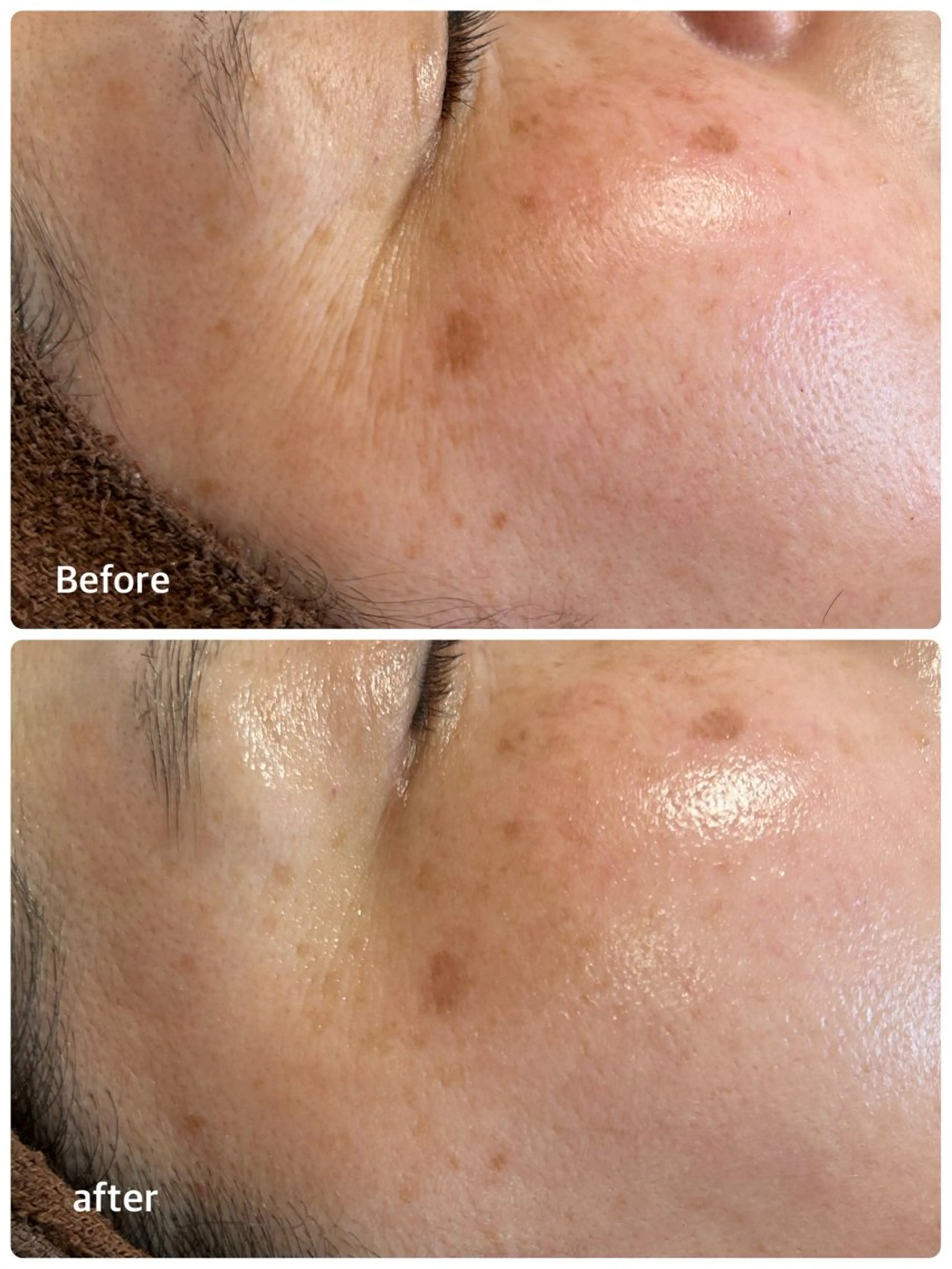 エステ リラク ビューティーサロン Claireのエステ・リラクイメージ