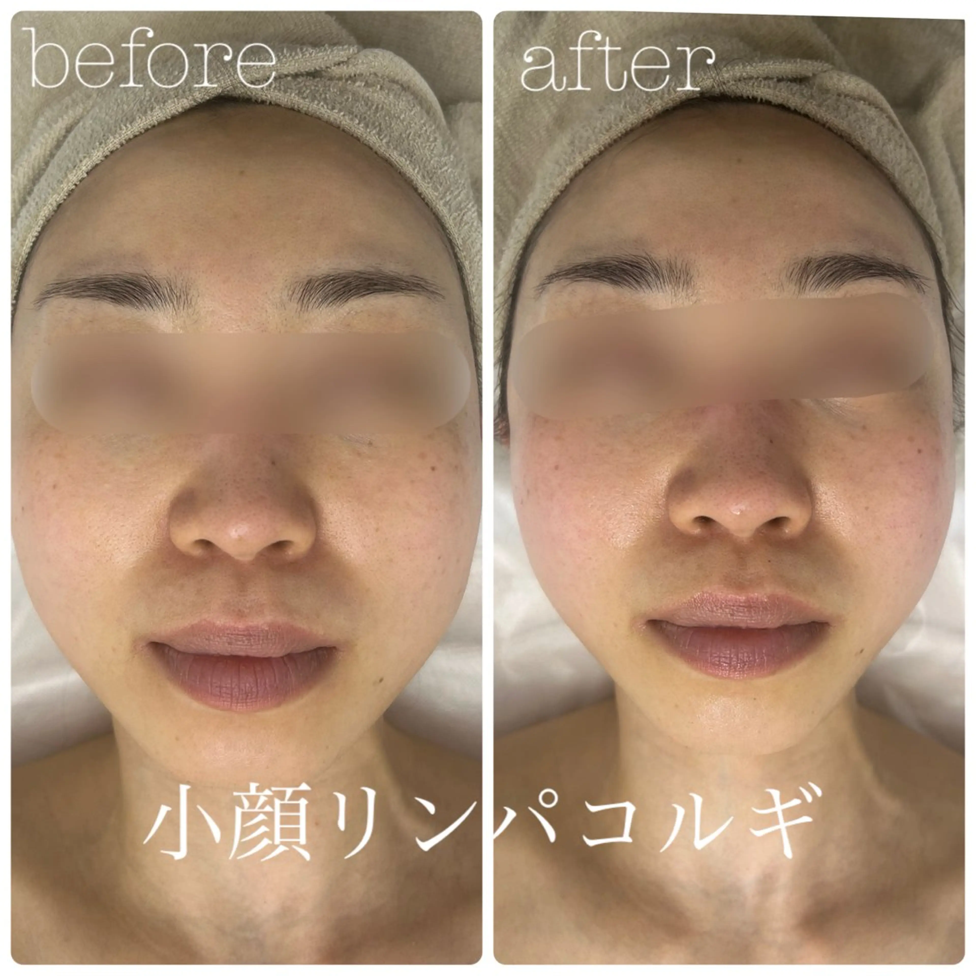 フェイシャルサロン CHIARA 荒田のエステ・リラクイメージ