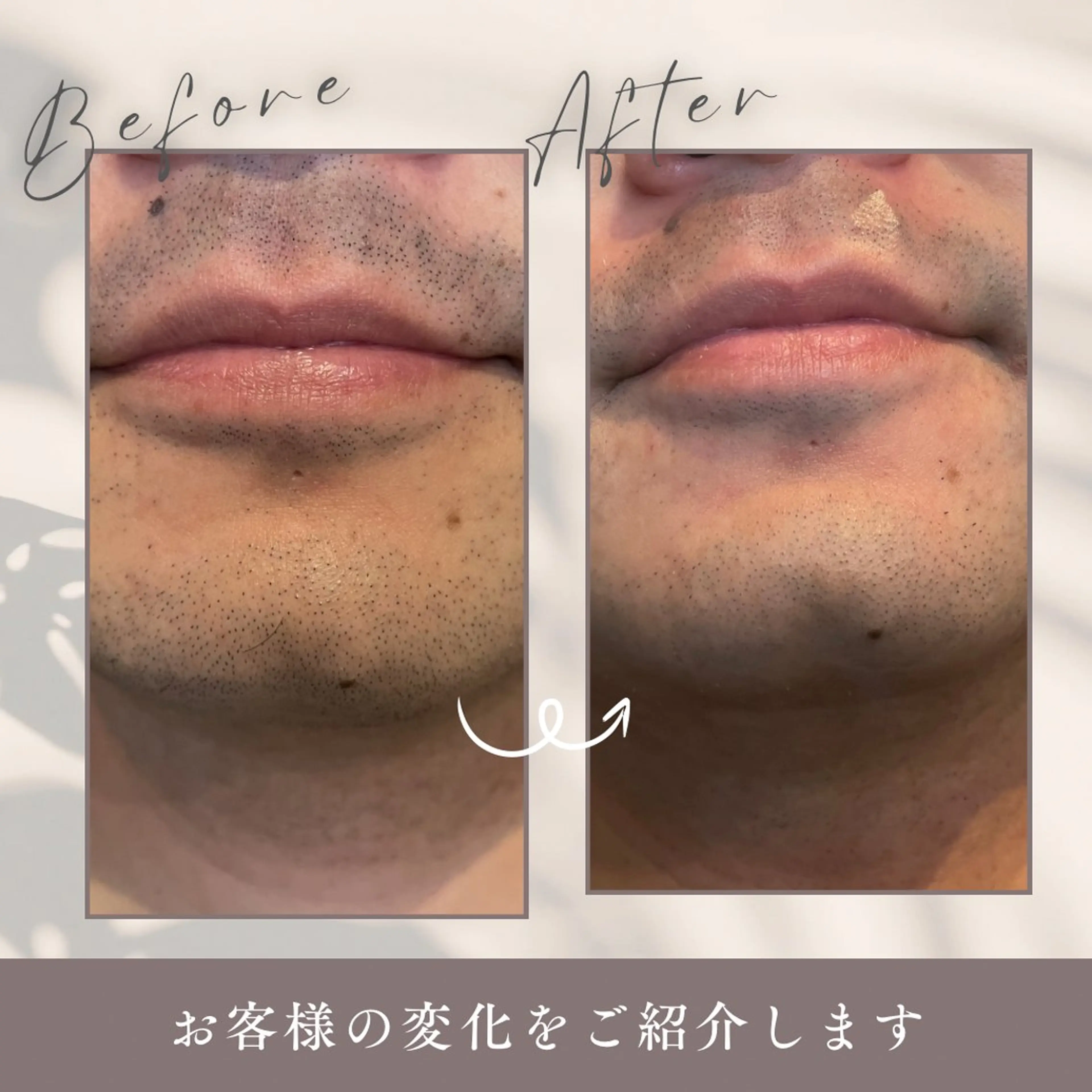 メンズ Salon  LUMINA所属・真栄平 美咲のエステ・リラクイメージ