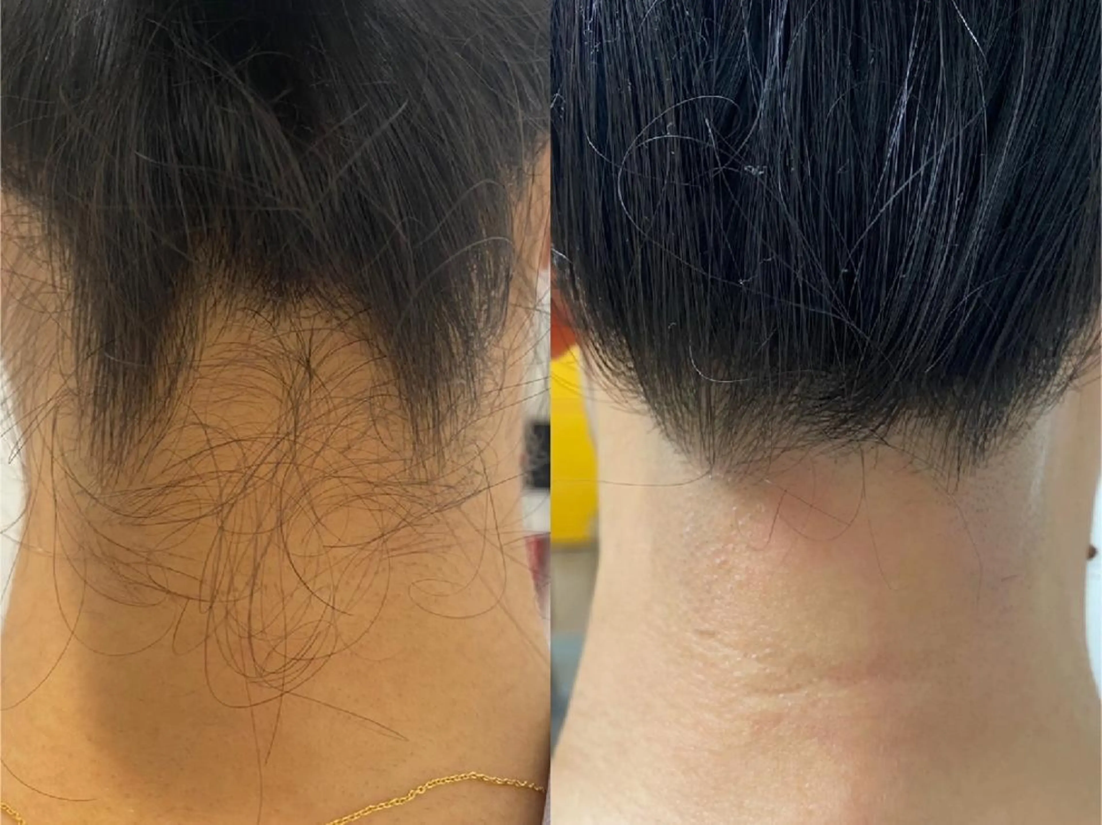 みんなの脱毛 TSURURINの眉毛・アイブロウイメージ