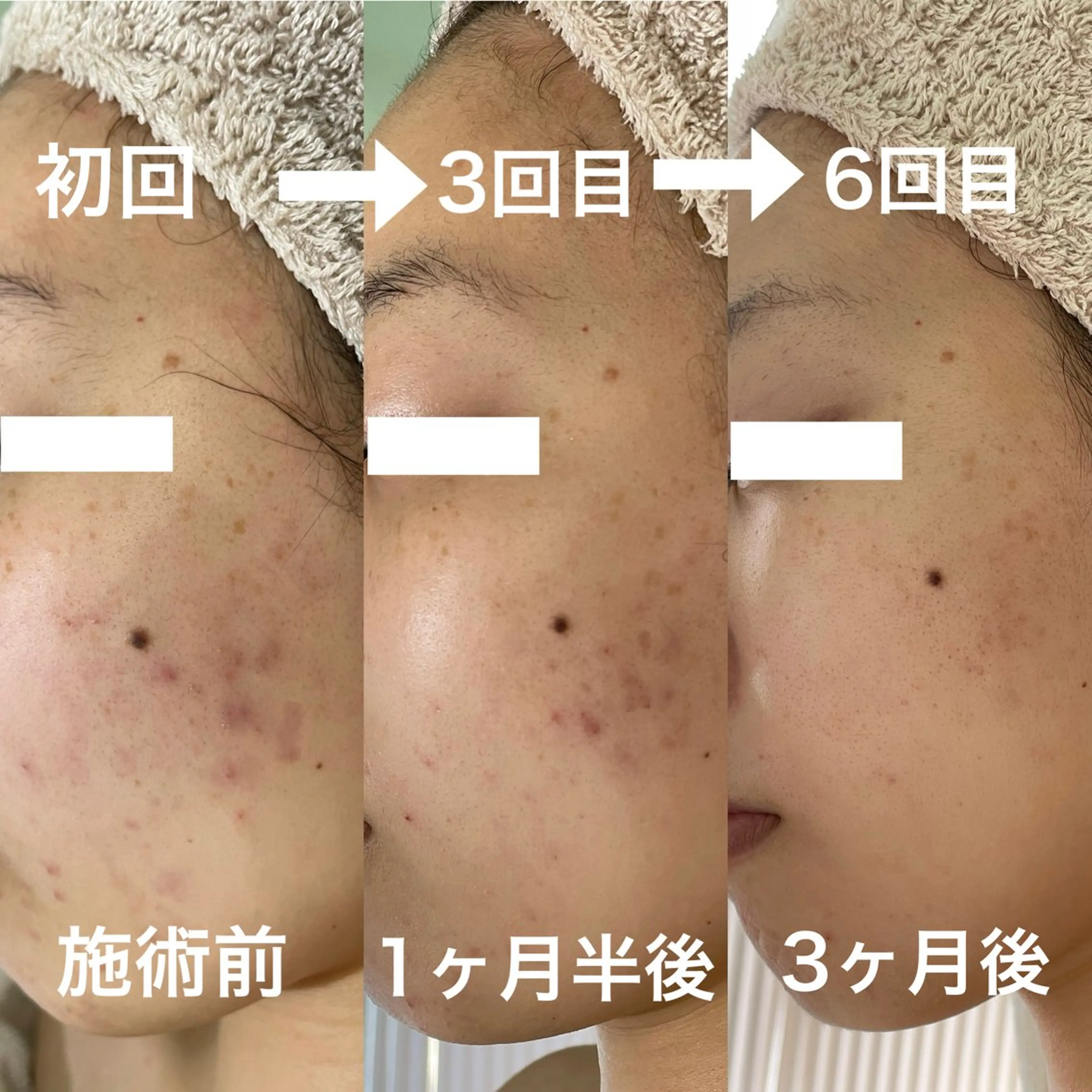 シェノン所属・ニキビ・毛穴・ フェイシャル専門店のその他イメージ