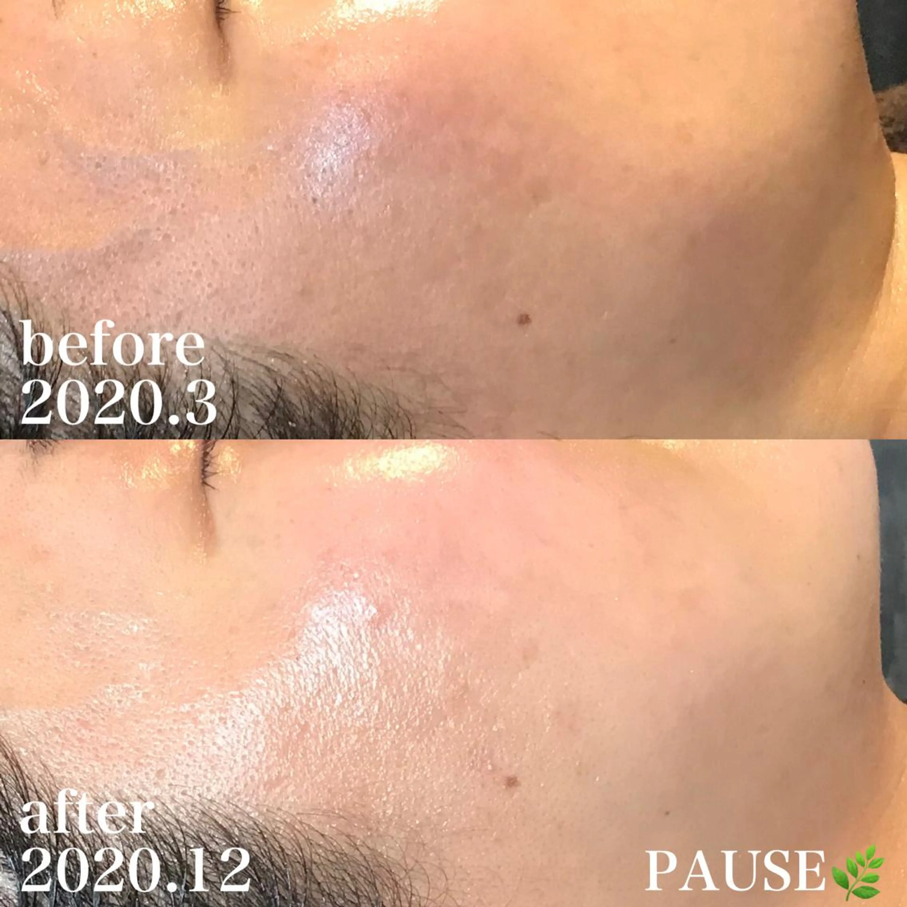 エステ 浜野 恵美のエステ・リラクイメージ