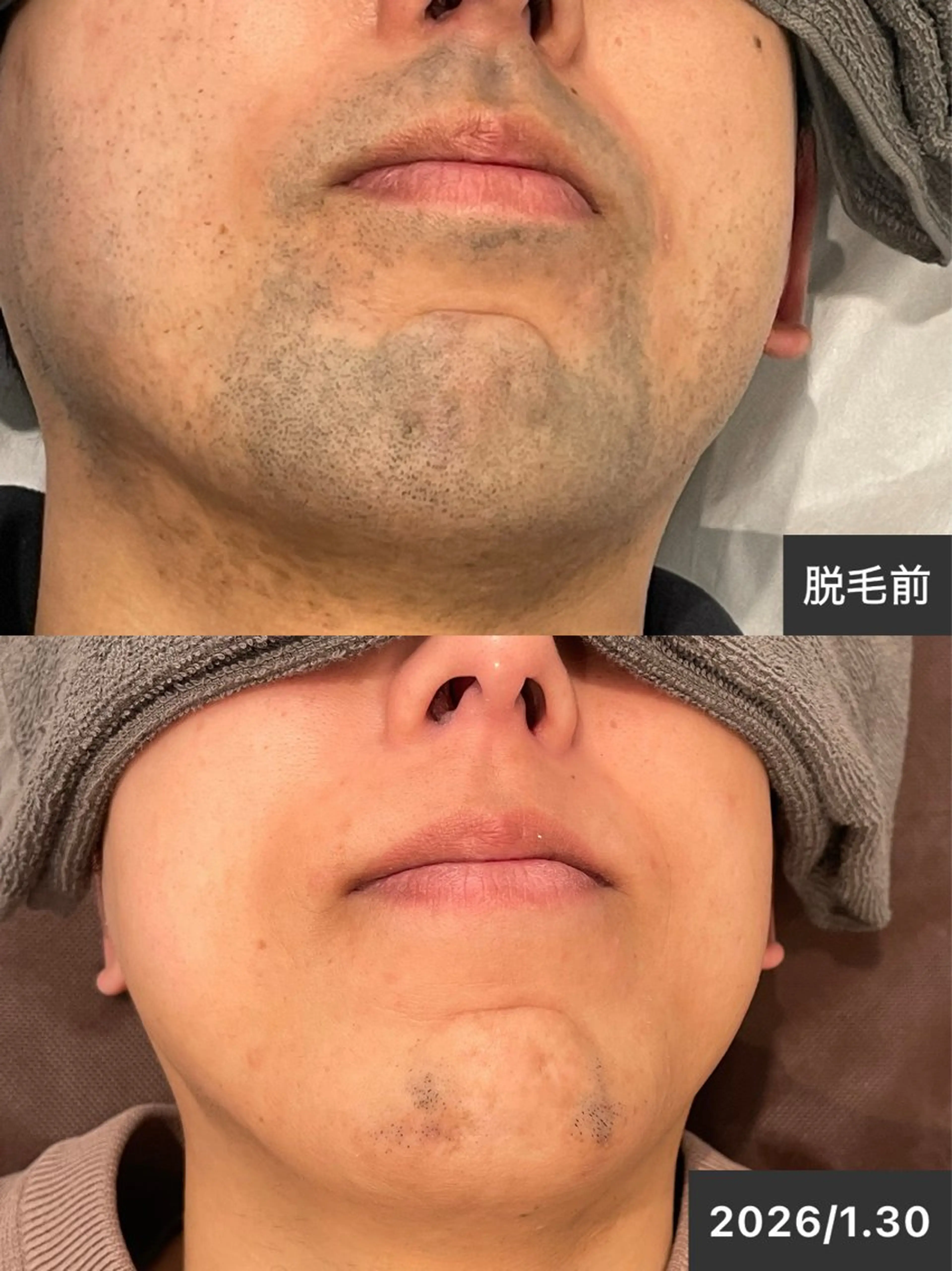 ELEGANCE所属・メンズ脱毛サロン BRIGHTのエステ・リラクイメージ