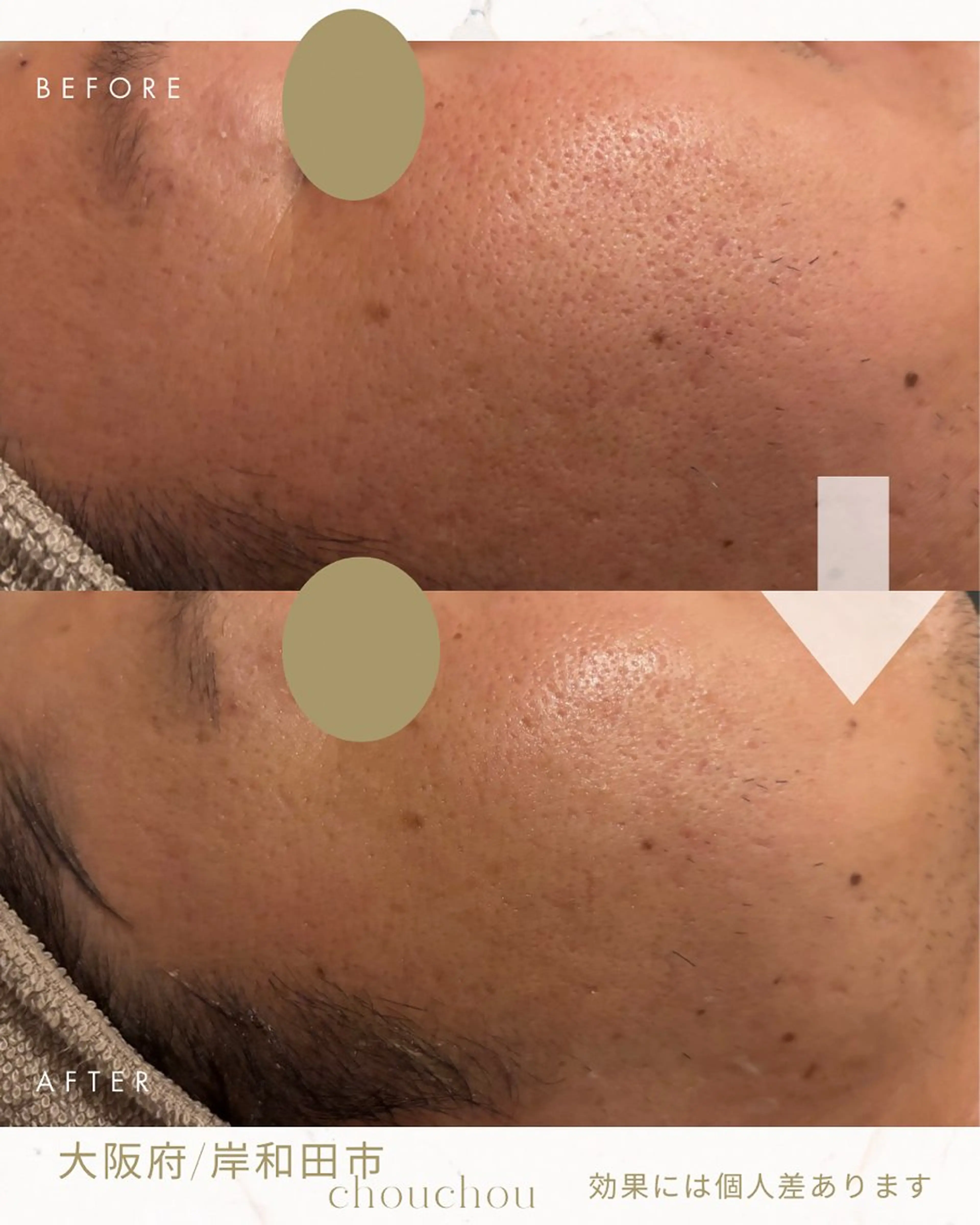 chouchou minaのエステ・リラクイメージ