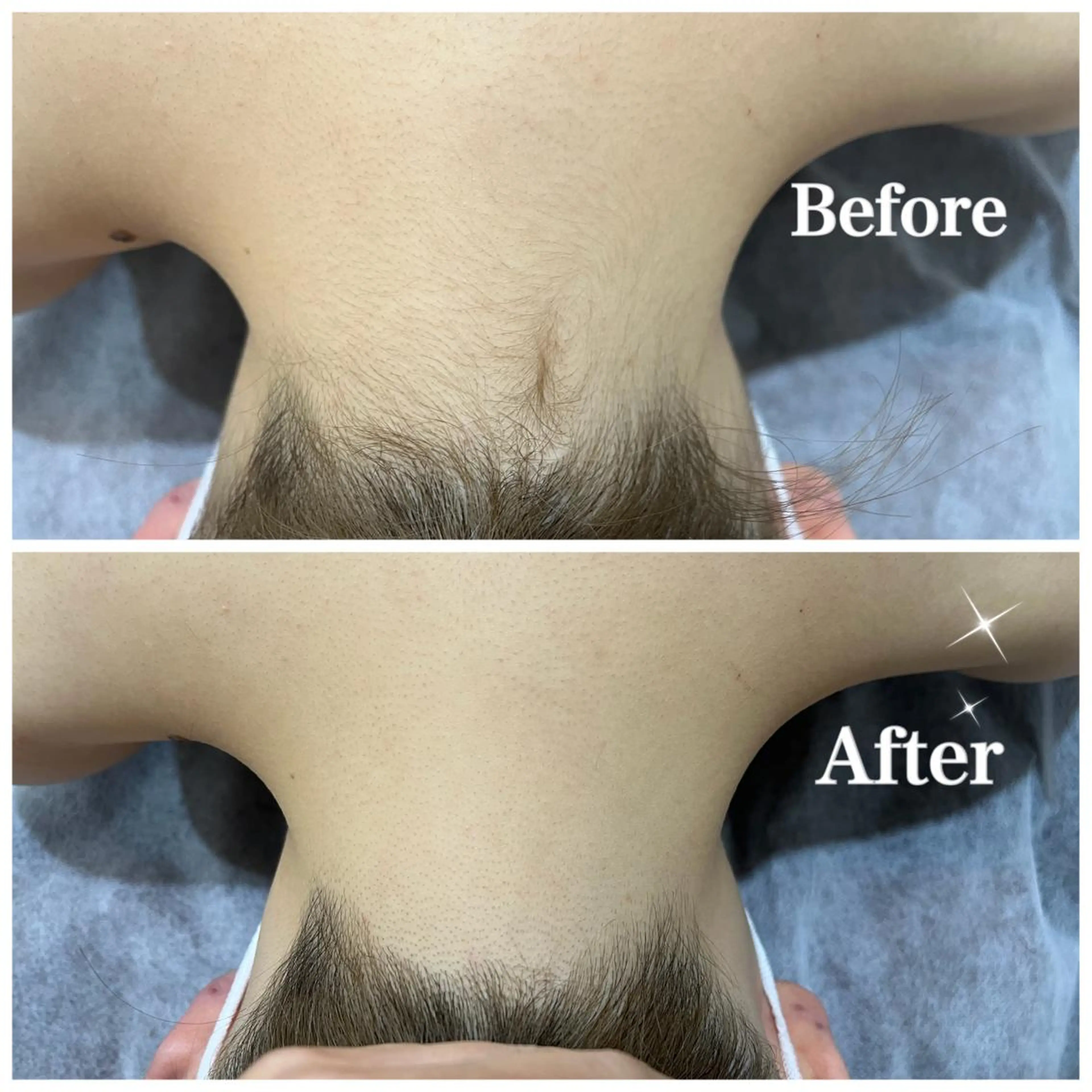 脱毛サロン fam.豊澤柚良のエステ・リラクイメージ