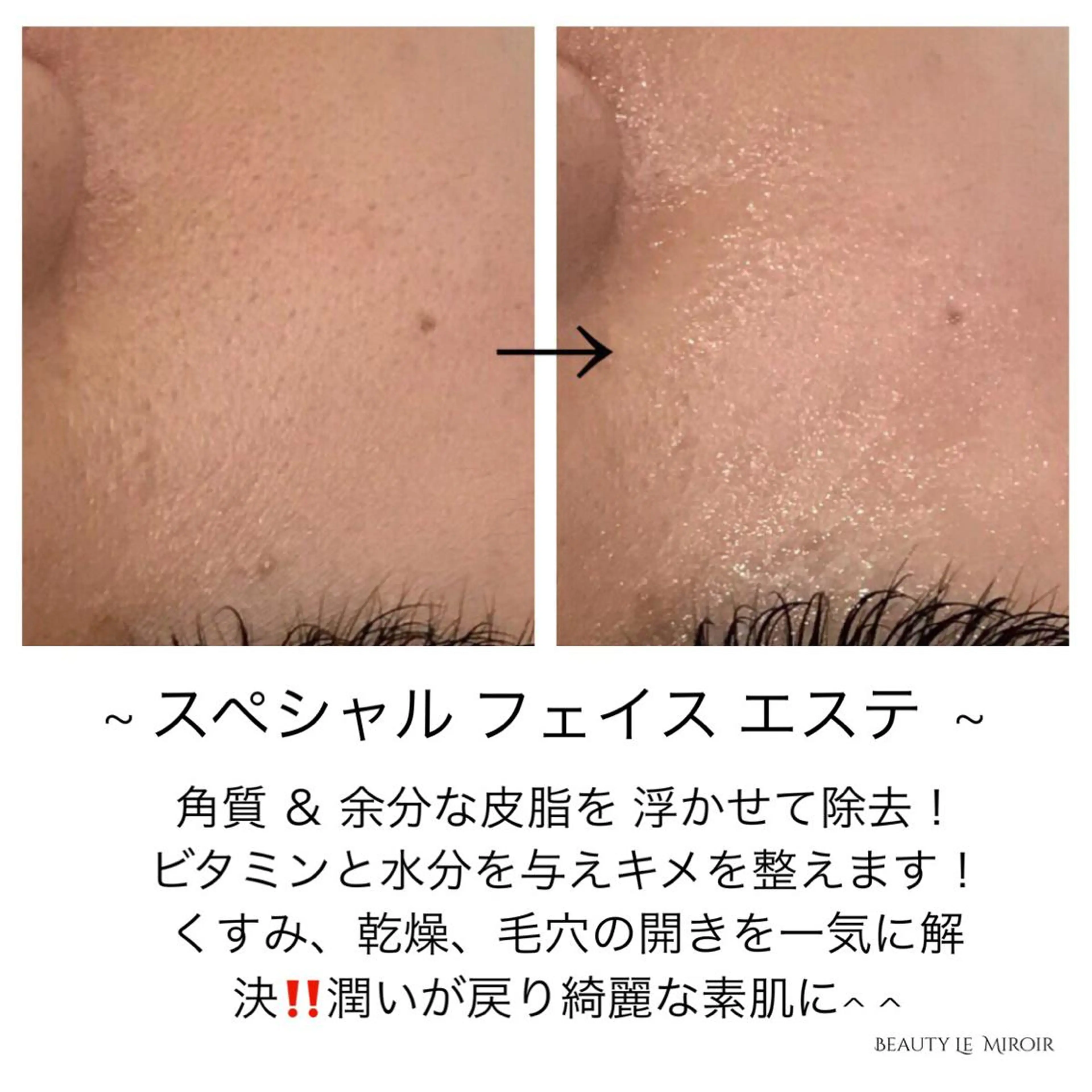 ビューティー ミロワールのエステ・リラクイメージ