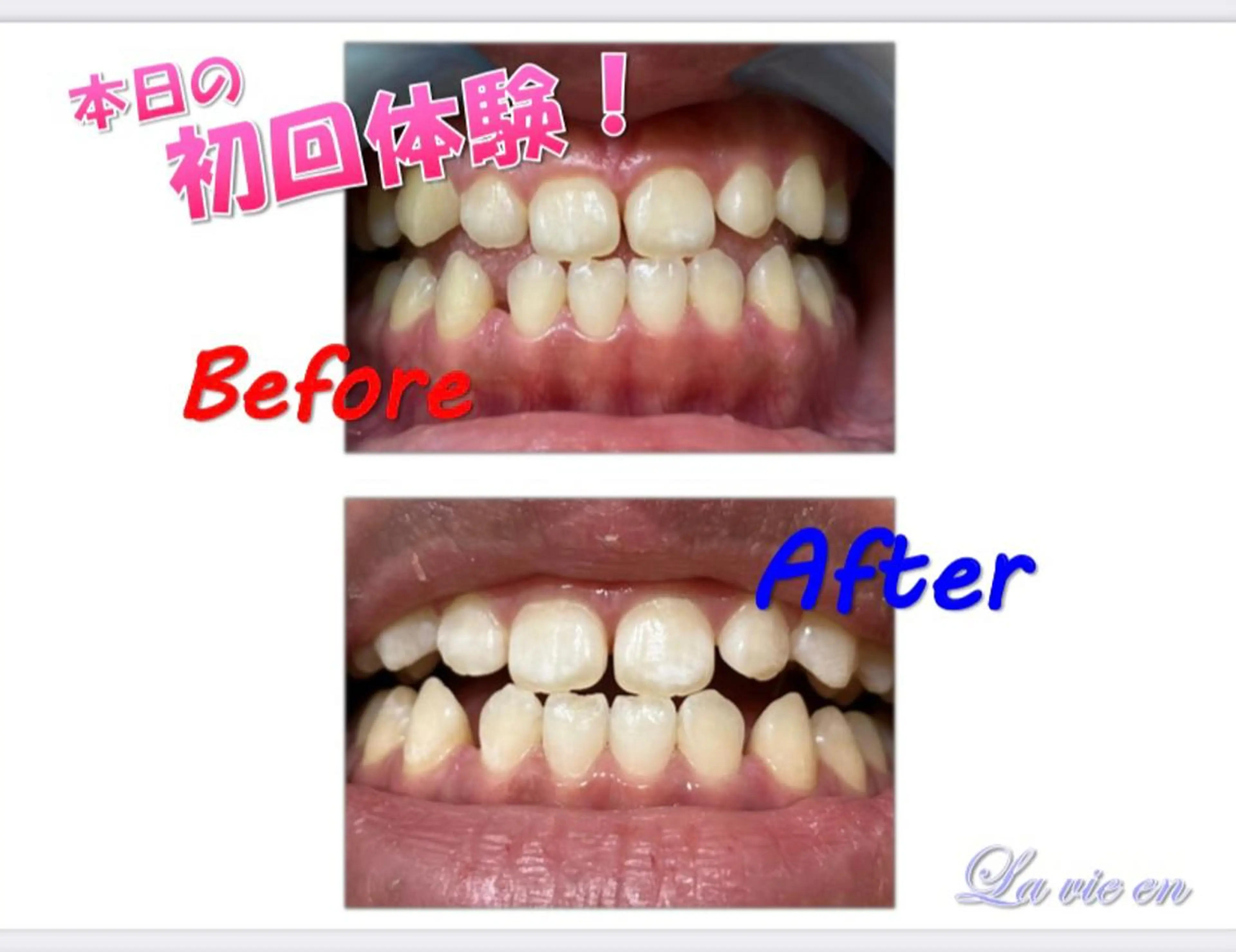その他 セルフホワイトニングサロン　ラヴィアン所属・ホワイトニングサロン La vie enのその他イメージ