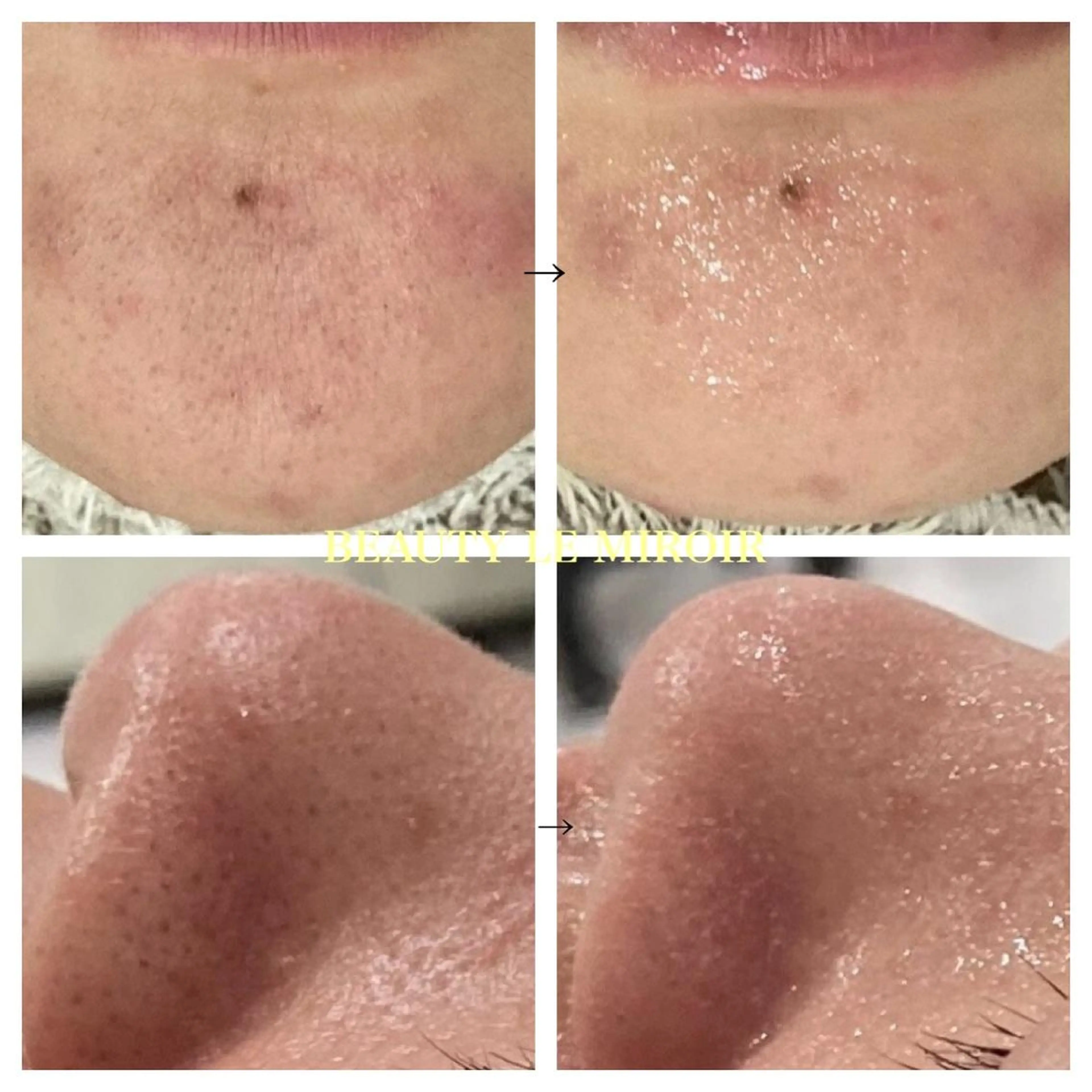 ビューティー ミロワールのエステ・リラクイメージ