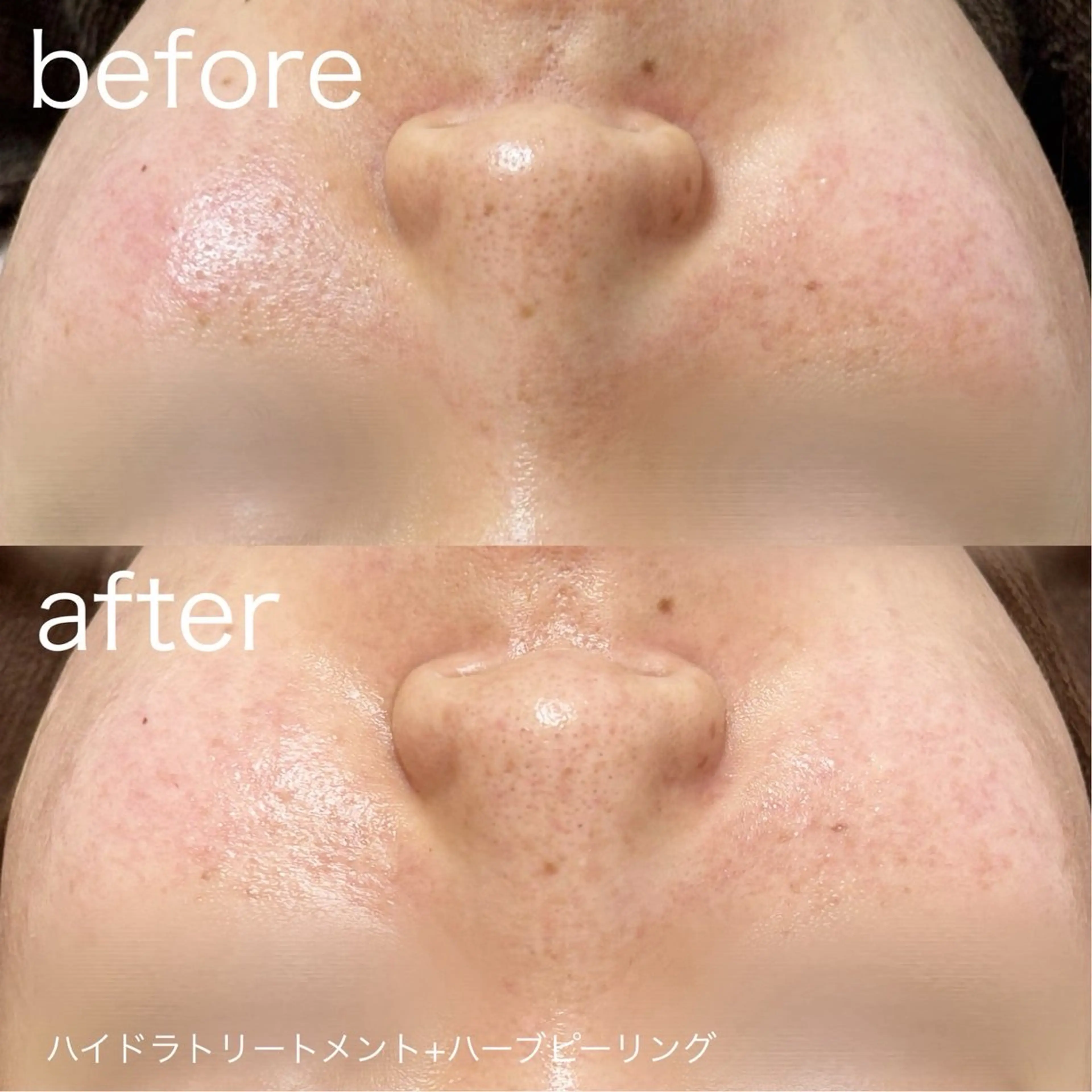 脱毛 lulularico Yuのエステ・リラクイメージ