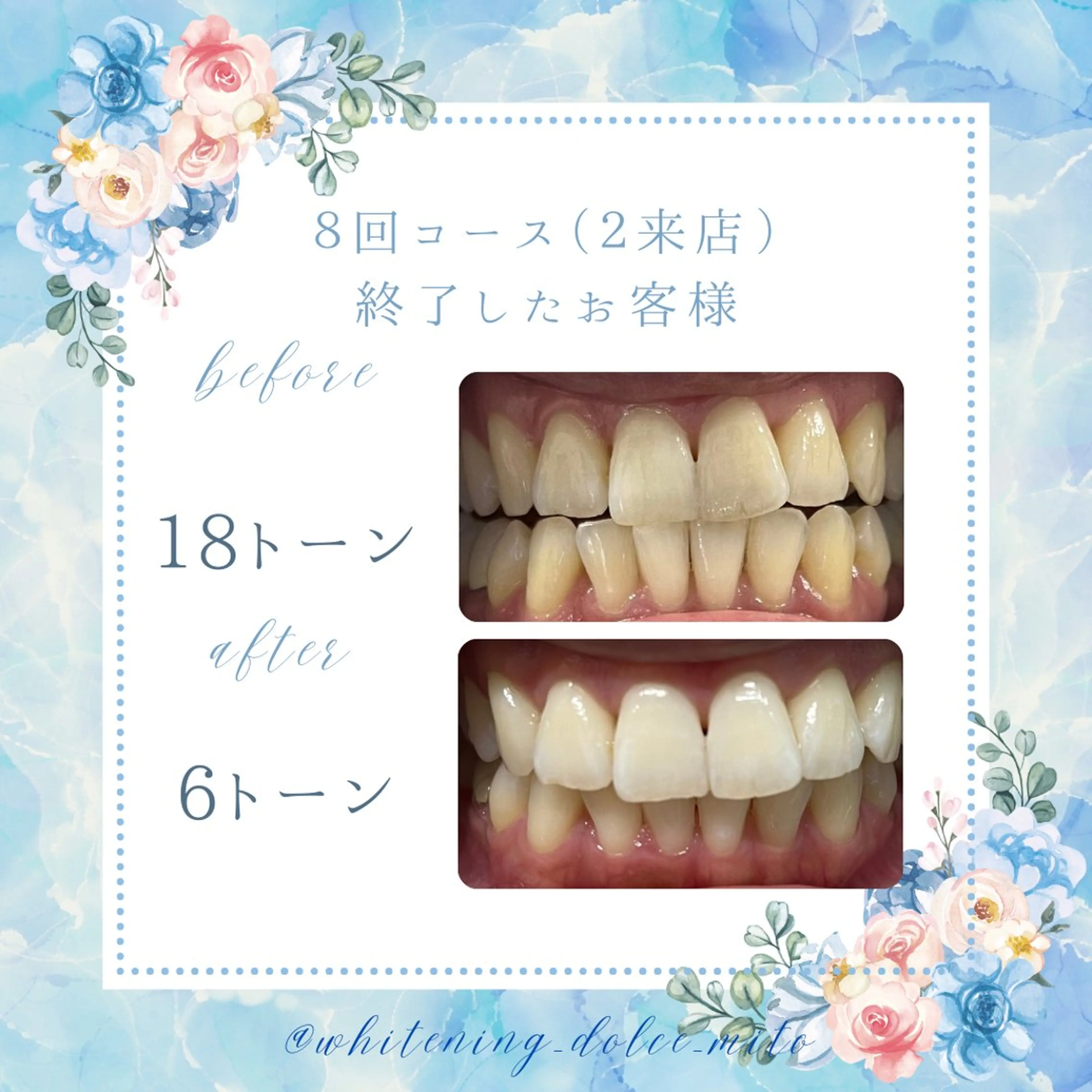 セルフホワイトニング Dolce水戸店のその他イメージ