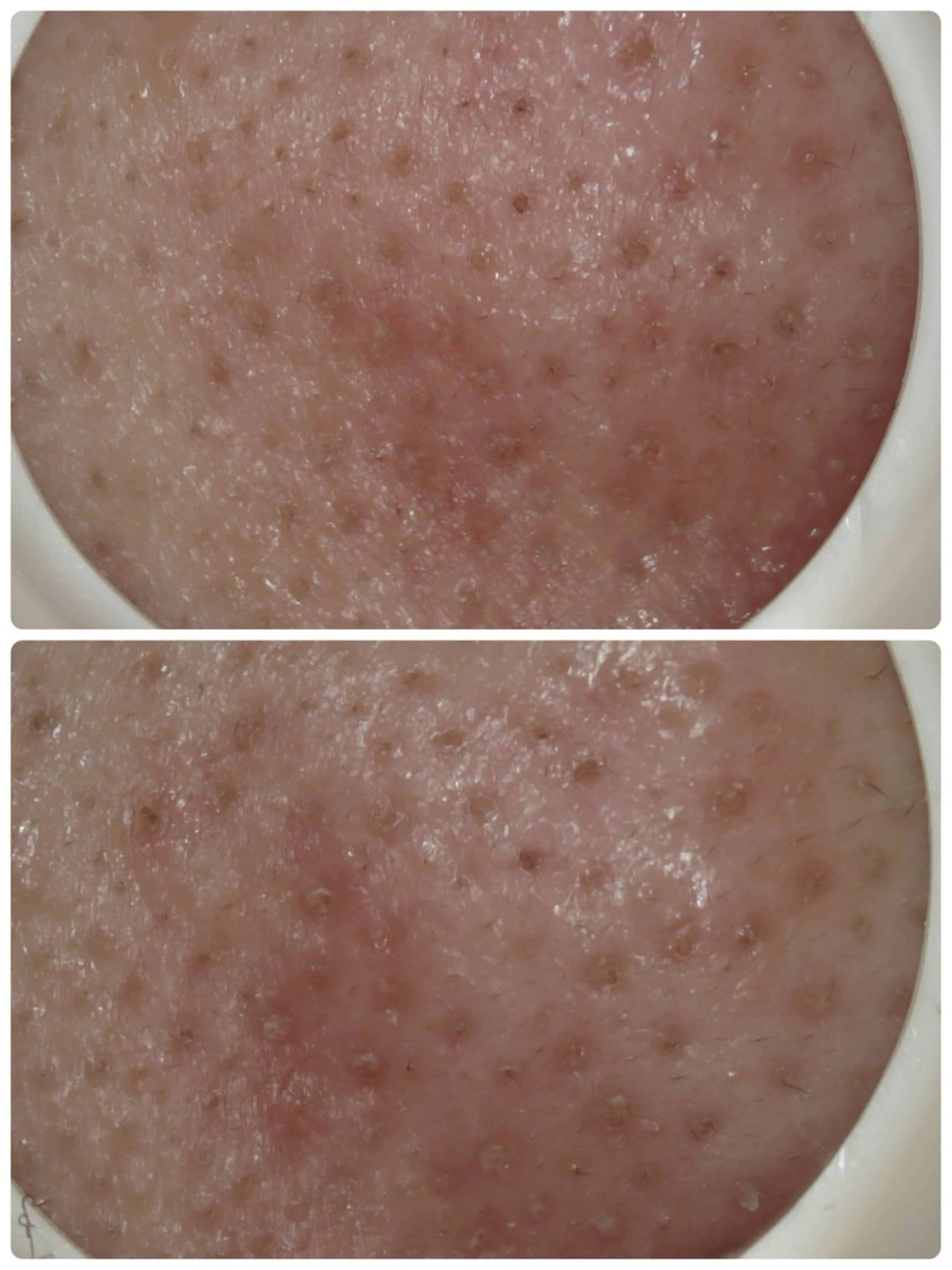 エステ リラク メナード片町 やまもと みくのエステ・リラクイメージ