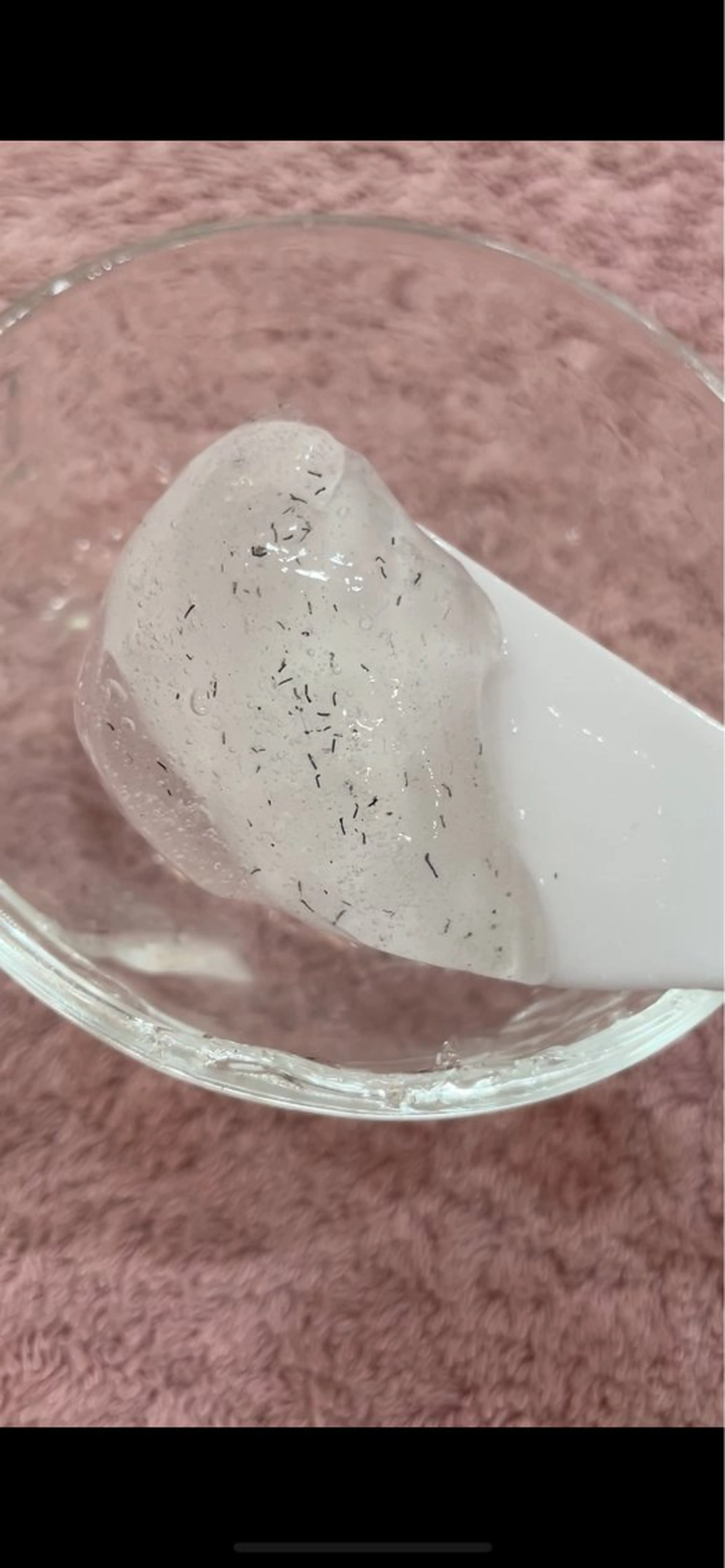 【女性VIO】自己処理後のチクチクから解放！ムレ、匂いの悩みも軽減！粘膜ギリギリまで丁寧に対応！の写真