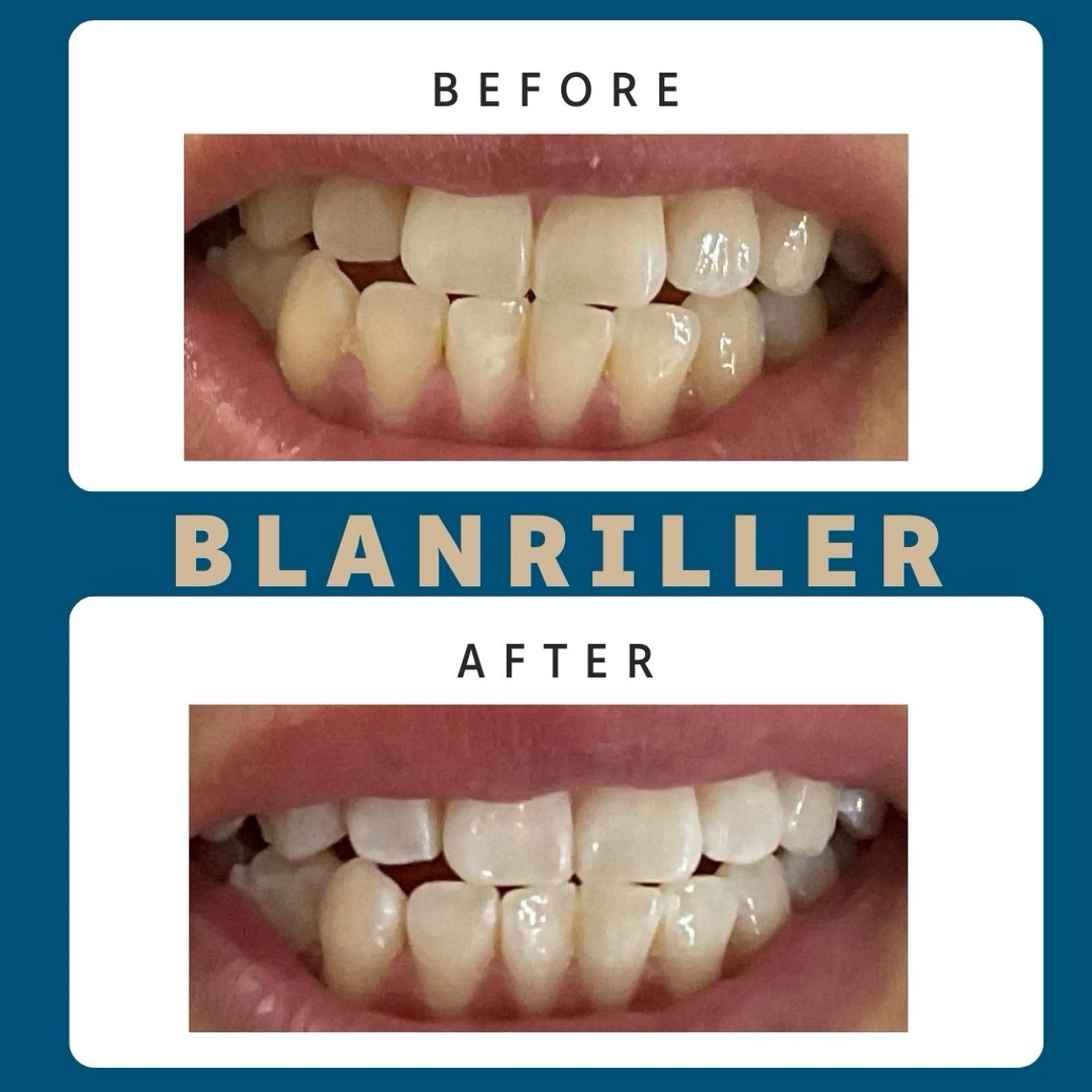 その他 BLANRILLER所属・ホワイトニングサロン ブランリエ阿倍野店のその他イメージ