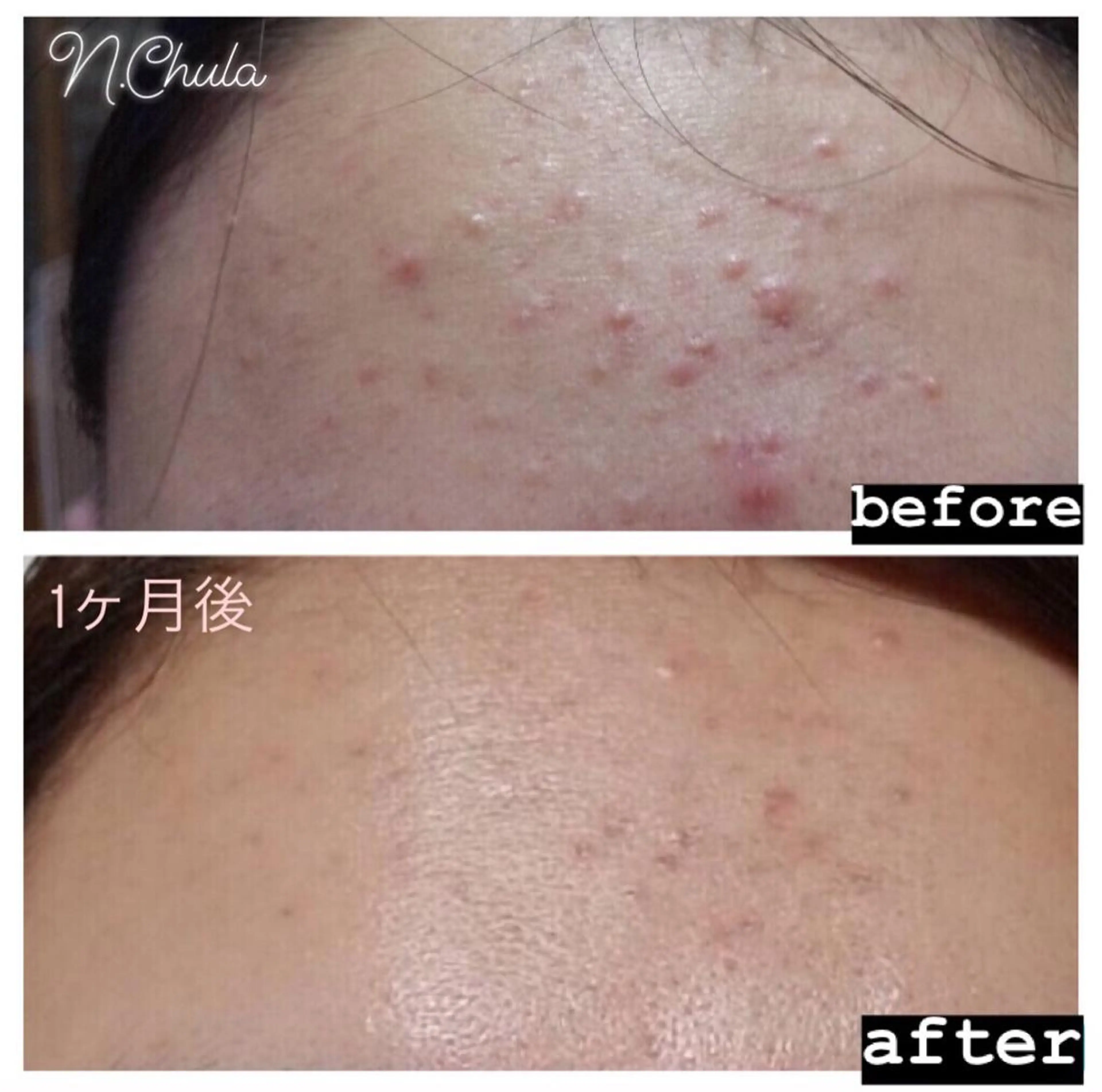 KOHAKU.所属・Nana Kikutaのエステ・リラクイメージ