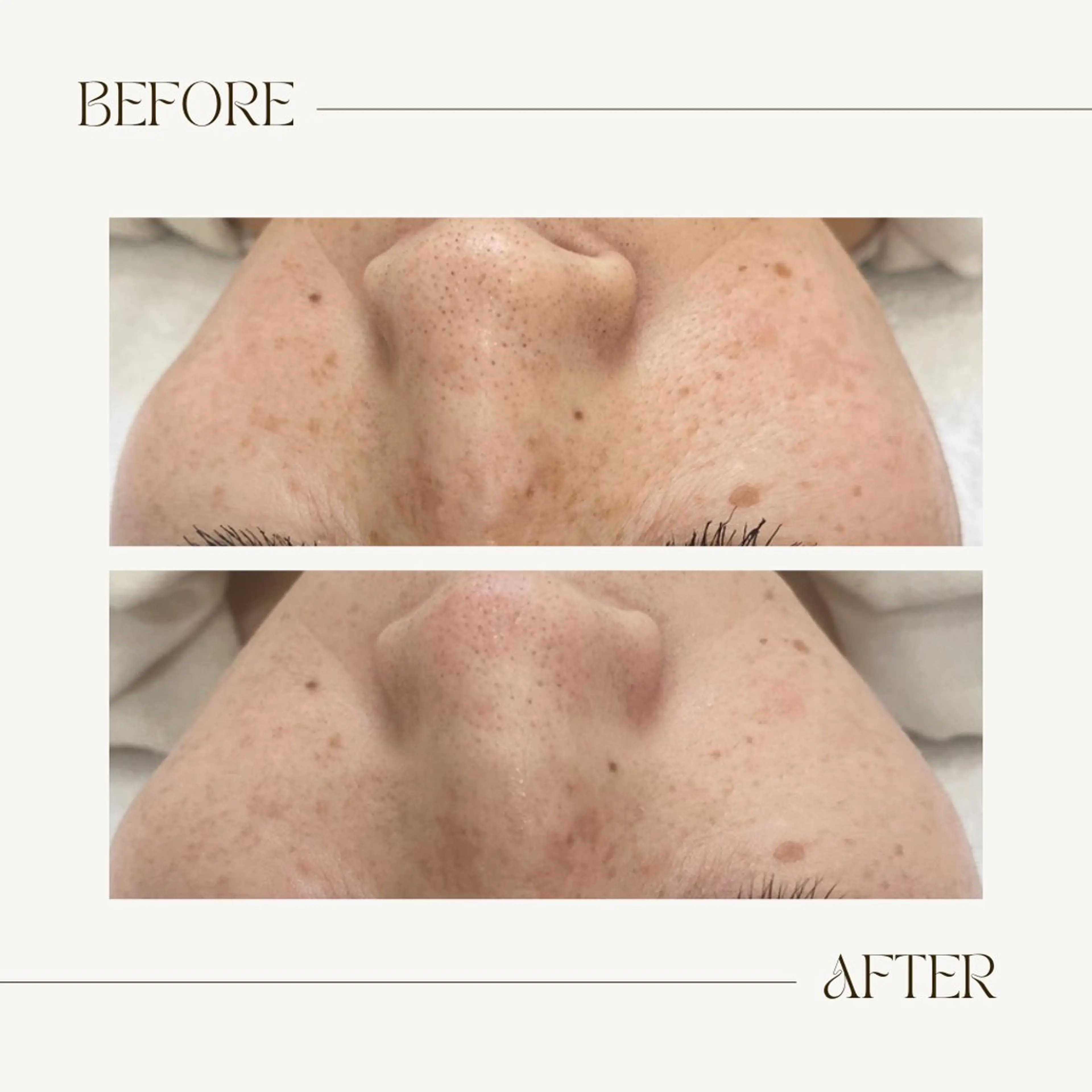 CEsalonEgg 齋藤のエステ・リラクイメージ