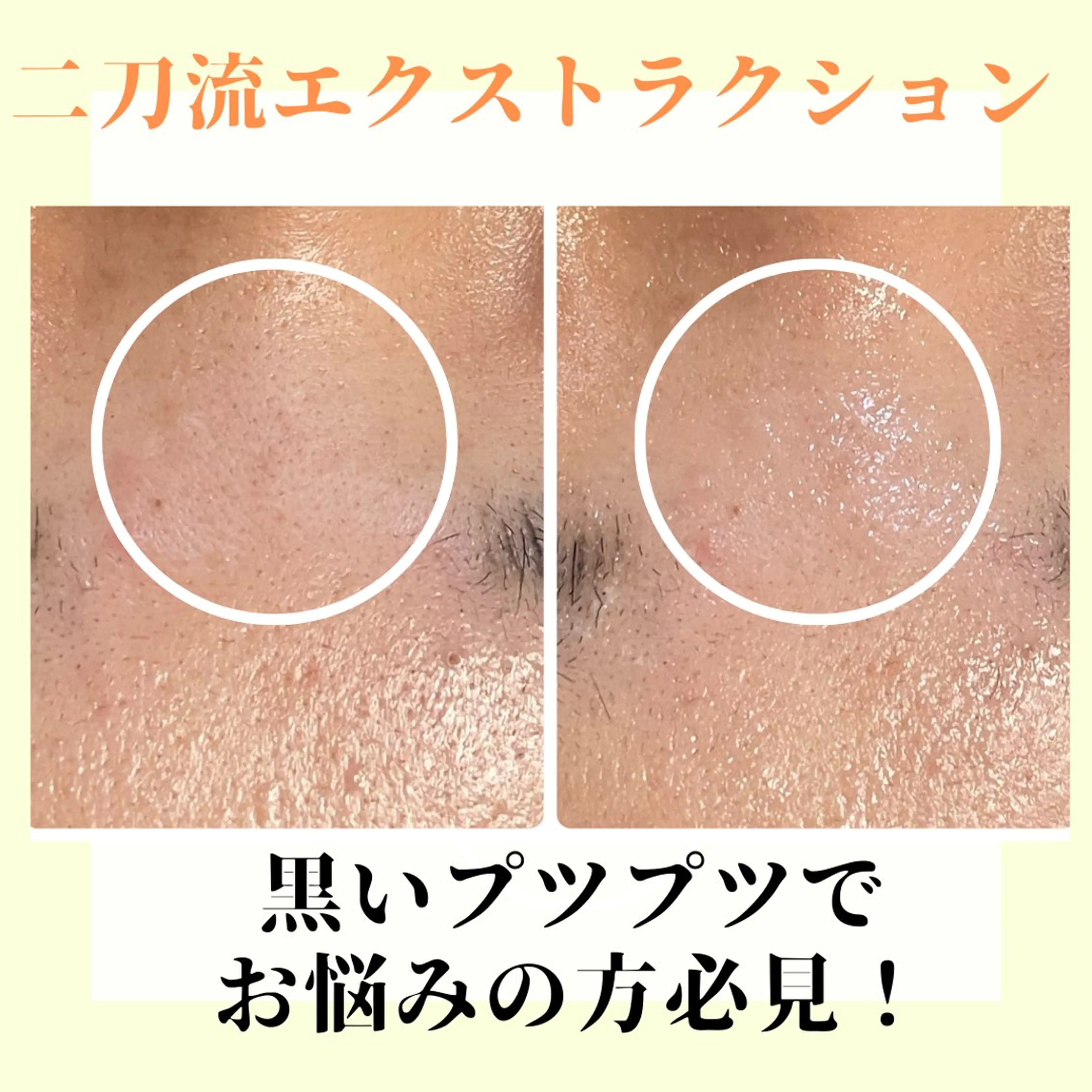 ピーリング専門店 Belluteのエステ・リラクイメージ