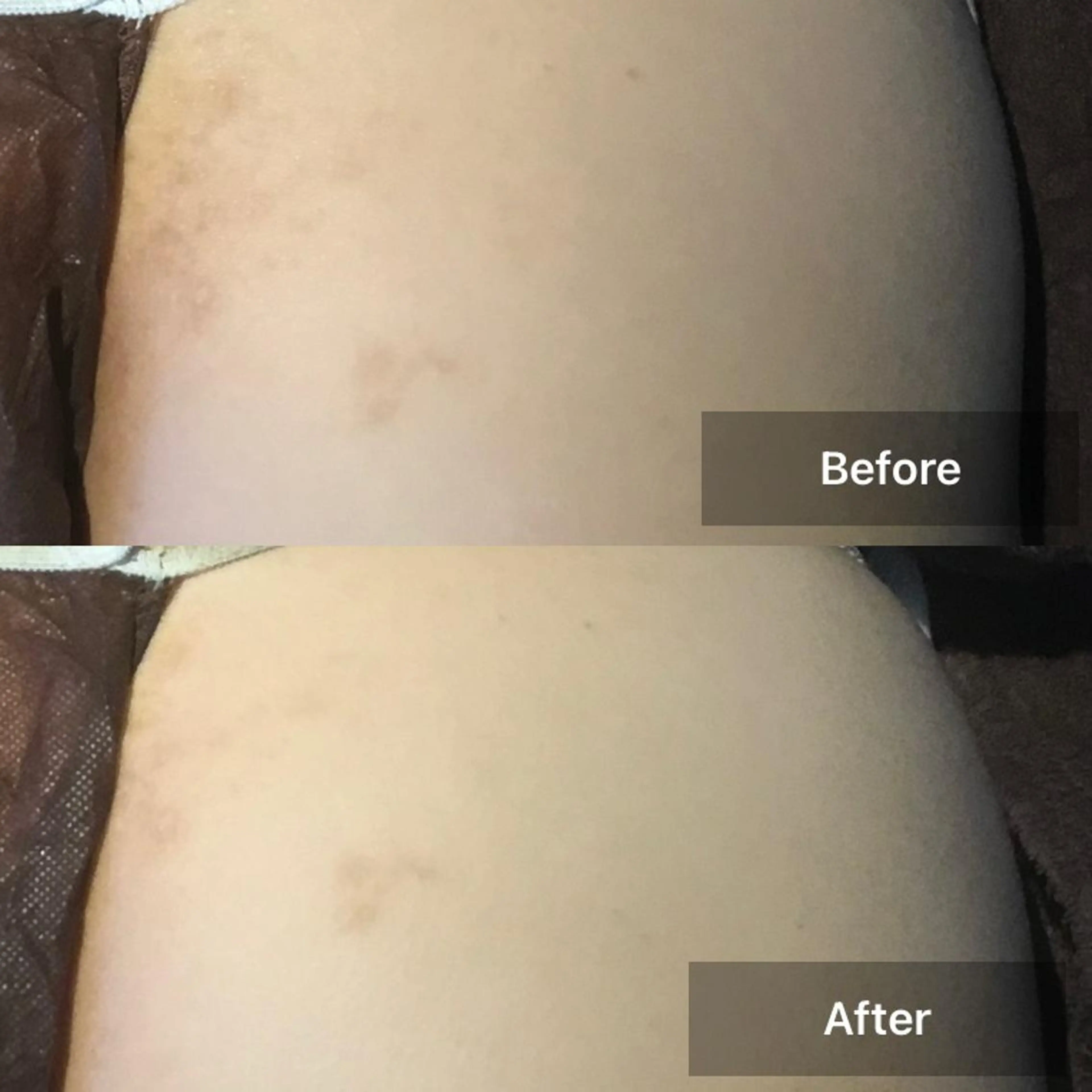 メンズ 美肌・リラクゼーションサロンLu,Mie所属・美肌と癒しのサロン Lu,Mieのエステ・リラクイメージ