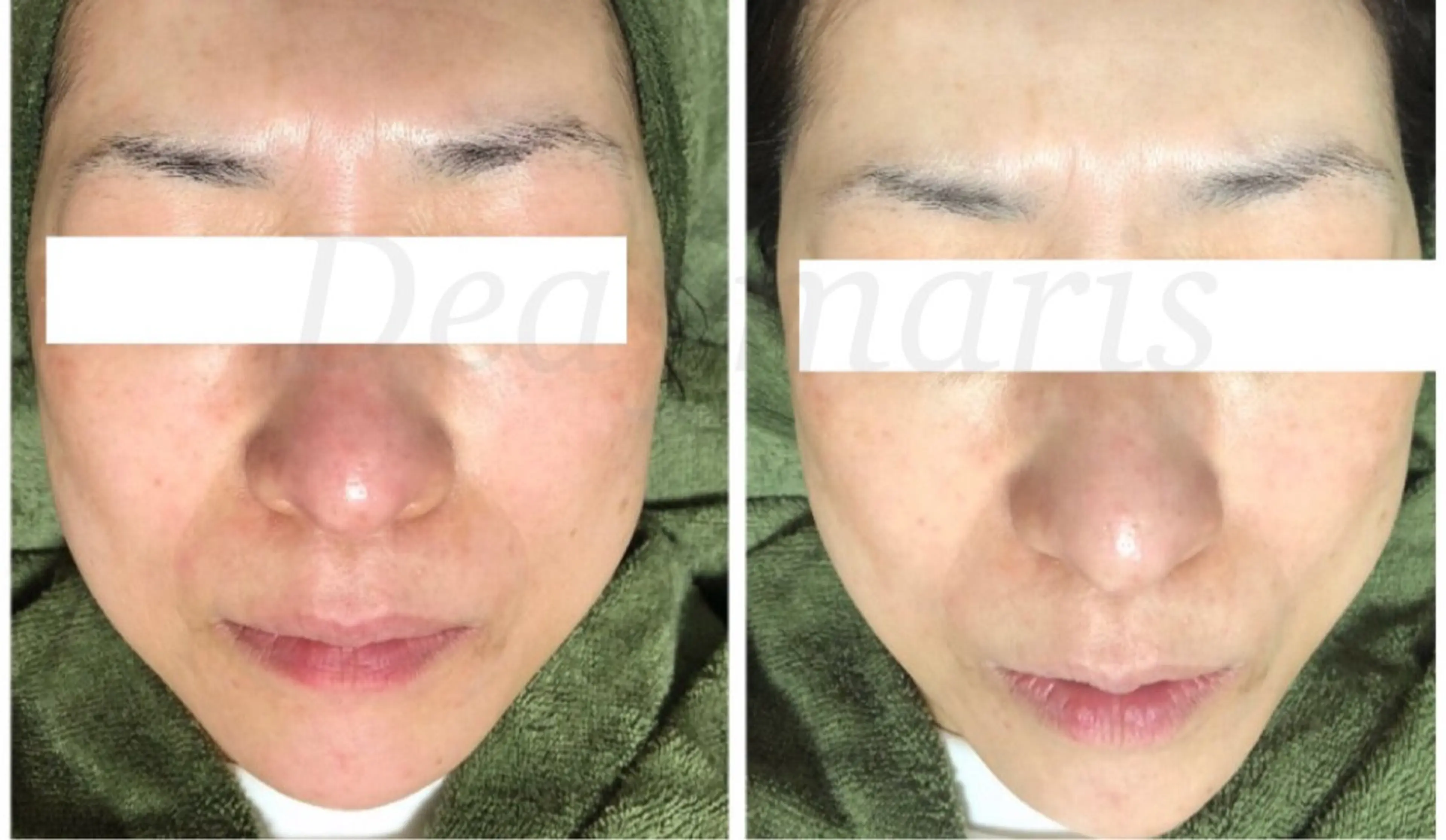 private salon  Dea_maris シュガーリング＆パーソナルボディケア所属・シミ改善・韓国肌管理 ボディメイク痩身のその他イメージ